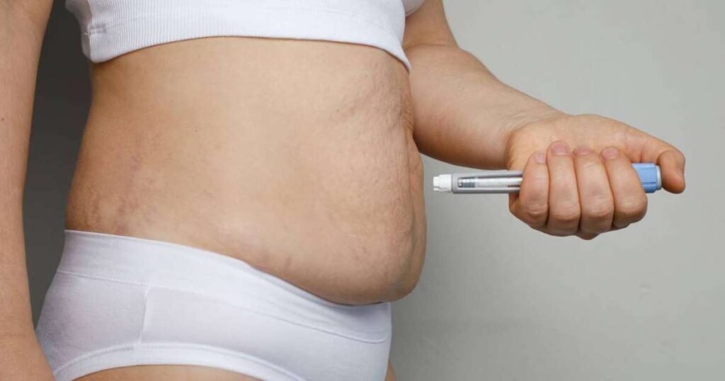 De acordo com o site Terra, a procura por métodos de emagrecimento seguros tem apresentado um crescimento constante ao longo dos anos. Nesse contexto, os medicamentos conhecidos popularmente como "canetas emagrecedoras" estão se tornando cada vez mais comuns nas prescrições médicas. Esses dispositivos, que oferecem uma forma prática de administração de medicamentos para perda de peso, têm atraído a atenção tanto de profissionais de saúde quanto de pacientes que buscam alternativas eficazes para o controle do peso corporal. Segundo a publicação, as "canetas emagrecedoras" funcionam através da aplicação de substâncias que auxiliam na redução do apetite e no controle do metabolismo, contribuindo assim para a perda de peso. Esses medicamentos são considerados uma inovação no tratamento da obesidade e do sobrepeso, oferecendo uma opção adicional para aqueles que não obtiveram sucesso com dietas e exercícios físicos isoladamente. A popularidade crescente desses dispositivos reflete uma tendência global de busca por soluções práticas e eficazes para o emagrecimento, especialmente em um cenário onde a obesidade é considerada um problema de saúde pública. O site Terra destaca ainda que, no Brasil, a aprovação e regulamentação desses medicamentos são realizadas pela Agência Nacional de Vigilância Sanitária (Anvisa). A aprovação pela Anvisa é um passo crucial para garantir a segurança e eficácia dos produtos disponíveis no mercado. A publicação enfatiza a importância de que qualquer tratamento para emagrecimento, incluindo o uso de "canetas emagrecedoras", seja realizado sob orientação médica, garantindo assim que o paciente receba o acompanhamento necessário e que os riscos associados ao uso inadequado sejam minimizados. Dessa forma, a busca por métodos seguros e eficazes de emagrecimento continua a ser uma prioridade tanto para os profissionais de saúde quanto para os pacientes.