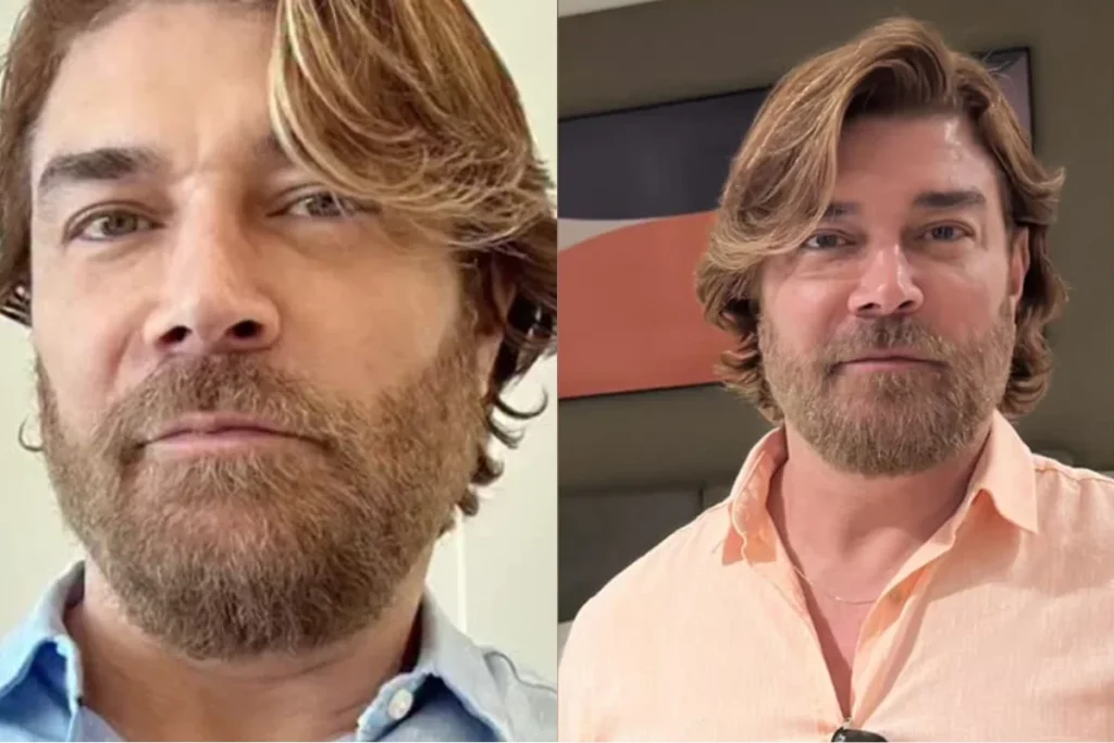 Quem é Clécio Souto e por que ele foi resgatado? Clécio Souto é um ator e dublador que foi resgatado após publicar uma mensagem de despedida no Instagram, revelando um momento emocional delicado. Qual foi o conteúdo da mensagem de despedida de Clécio? Ele expressou gratidão pelo apoio recebido, mencionou dificuldades pessoais e profissionais, e indicou que buscava paz fora do cenário atual. Quais fatores agravaram o estado emocional de Clécio? A solidão, problemas financeiros e poucas oportunidades de trabalho afetaram sua saúde mental, levando-o a considerar interromper sua trajetória. Como os seguidores reagiram à publicação de Clécio? Houve uma mobilização imediata nos comentários, com pedidos para acionar autoridades e familiares, resultando no rápido resgate do ator. Quem prestou socorro a Clécio Souto? O Serviço de Atendimento Móvel de Urgência (Samu) foi acionado e resgatou Clécio, encaminhando-o para atendimento médico especializado. Qual é o estado atual de Clécio Souto? Ele está sob supervisão médica e acompanhado por amigos, que destacam a importância de oferecer suporte para sua recuperação. Como buscar ajuda em situações semelhantes à de Clécio? No Brasil, o Centro de Valorização da Vida oferece apoio emocional gratuito pelo telefone 188 ou via chat no site oficial, 24 horas por dia.