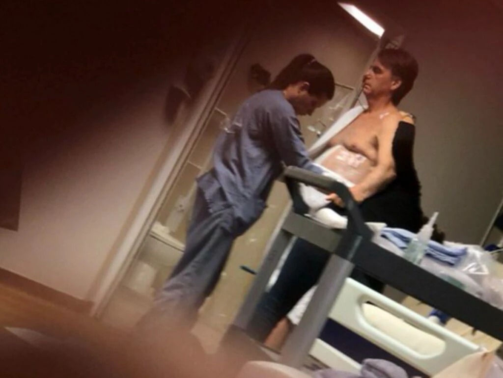 Carlos Bolsonaro visitou seu pai, o ex-presidente Jair Bolsonaro, nesta segunda-feira (16) e relatou que, apesar de uma leve melhora em seu estado de saúde, o quadro ainda é considerado **delicado**. Jair Bolsonaro foi transferido para uma unidade semi-intensiva após passar quatro dias na UTI do Hospital DF Star, em Brasília. A mudança de unidade foi possível devido a uma melhora no quadro clínico, mas ele ainda enfrenta uma **pneumonia bacteriana** que requer atenção constante. Segundo a publicação, Carlos Bolsonaro destacou que o estado de saúde do pai continua a ser monitorado de perto pela equipe médica. A pneumonia bacteriana é uma infecção pulmonar que pode ser grave, especialmente em pacientes com saúde já debilitada. No caso de Jair Bolsonaro, a infecção tem sido um desafio adicional em sua recuperação. De acordo com o site, a equipe médica está empenhada em tratar a infecção com antibióticos e outros cuidados necessários para estabilizar o quadro clínico do ex-presidente. A transferência para a unidade semi-intensiva indica que houve uma melhora, mas ainda exige cuidados contínuos e monitoramento rigoroso para evitar complicações. O estado de saúde de Jair Bolsonaro tem sido motivo de preocupação para seus familiares e apoiadores. Carlos Bolsonaro, ao comentar sobre a situação, reforçou a necessidade de cautela e acompanhamento constante. Segundo a publicação, a família está esperançosa com a recuperação, mas ciente de que o processo pode ser lento e requerer paciência. A situação de saúde do ex-presidente continua a ser um assunto de interesse nacional, com atualizações frequentes sobre seu progresso e tratamento.