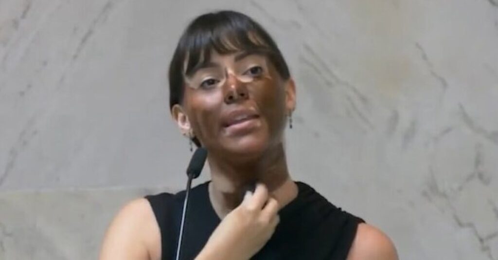 A **deputada estadual** realizou um ato de **"blackface"** como forma de protesto contra a eleição de **Erika Hilton** como presidente da Comissão da Mulher na Câmara. Esse ato, que envolve a pintura do rosto para simular características de pessoas negras, gerou grande repercussão e debate sobre suas implicações raciais e políticas. Segundo a publicação, a deputada utilizou essa prática para questionar a legitimidade da eleição de Erika Hilton, destacando-se como um gesto controverso e amplamente criticado por ativistas e especialistas em questões raciais. O uso do **"blackface"** é historicamente carregado de conotações racistas, sendo uma prática que remonta ao século XIX, quando atores brancos pintavam seus rostos para representar estereótipos negativos de pessoas negras. Segundo o site, a ação da deputada foi vista por muitos como um retrocesso nos esforços de promoção da igualdade racial e de gênero. A eleição de Erika Hilton, uma mulher trans e negra, para a presidência da Comissão da Mulher, representa um marco significativo na luta por representatividade e diversidade na política. No entanto, a reação da deputada evidencia as tensões e resistências ainda presentes no cenário político brasileiro. A controvérsia em torno desse protesto levanta questões importantes sobre a **representatividade** e a **inclusão** nas instituições políticas. Segundo a publicação, a eleição de Erika Hilton simboliza um avanço na inclusão de vozes historicamente marginalizadas, enquanto o protesto da deputada ressalta os desafios persistentes na aceitação e valorização dessa diversidade. O episódio destaca a necessidade de um diálogo contínuo e construtivo sobre questões de raça e gênero, visando a construção de um ambiente político mais justo e igualitário.