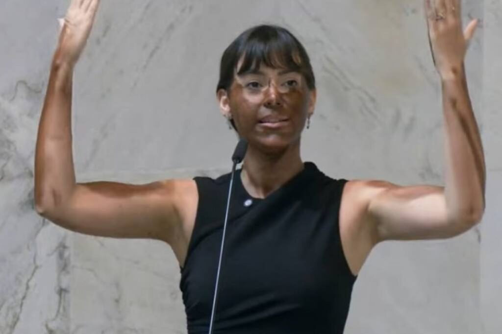 A deputada **Fabiana Bolsonaro** gerou polêmica ao se pintar de marrom em um ato de protesto contra a também deputada **Erika Hilton**. A ação foi amplamente criticada e classificada como **blackface** e **transfobia** por diversos parlamentares. Segundo a publicação, o gesto de Fabiana foi uma tentativa de atacar a identidade de Erika Hilton, que é uma mulher trans e negra, destacando tensões e debates sobre questões raciais e de gênero no cenário político brasileiro. O uso de tinta marrom no corpo por Fabiana Bolsonaro foi visto como uma forma de **desrespeito** e **intolerância**. O **blackface**, prática em que uma pessoa branca pinta o rosto para imitar pessoas negras, tem uma história de racismo e é considerado ofensivo e degradante. Segundo o site, parlamentares e ativistas rapidamente condenaram o ato, destacando que ele reforça estigmas e preconceitos históricos. Além disso, a ação foi vista como um ataque direto à identidade de Erika Hilton, que representa uma parcela significativa da população que luta por reconhecimento e igualdade de direitos. A repercussão do ato de Fabiana Bolsonaro trouxe à tona discussões sobre a responsabilidade de figuras públicas em promover o respeito e a inclusão. Segundo a publicação, muitos parlamentares pediram medidas disciplinares contra Fabiana, enfatizando a necessidade de combater atitudes que promovam o ódio e a discriminação. O episódio destaca a importância de um debate contínuo sobre **diversidade**, **respeito** e **igualdade** no Brasil, especialmente em um momento em que questões de identidade e representatividade estão cada vez mais em evidência no cenário político e social.