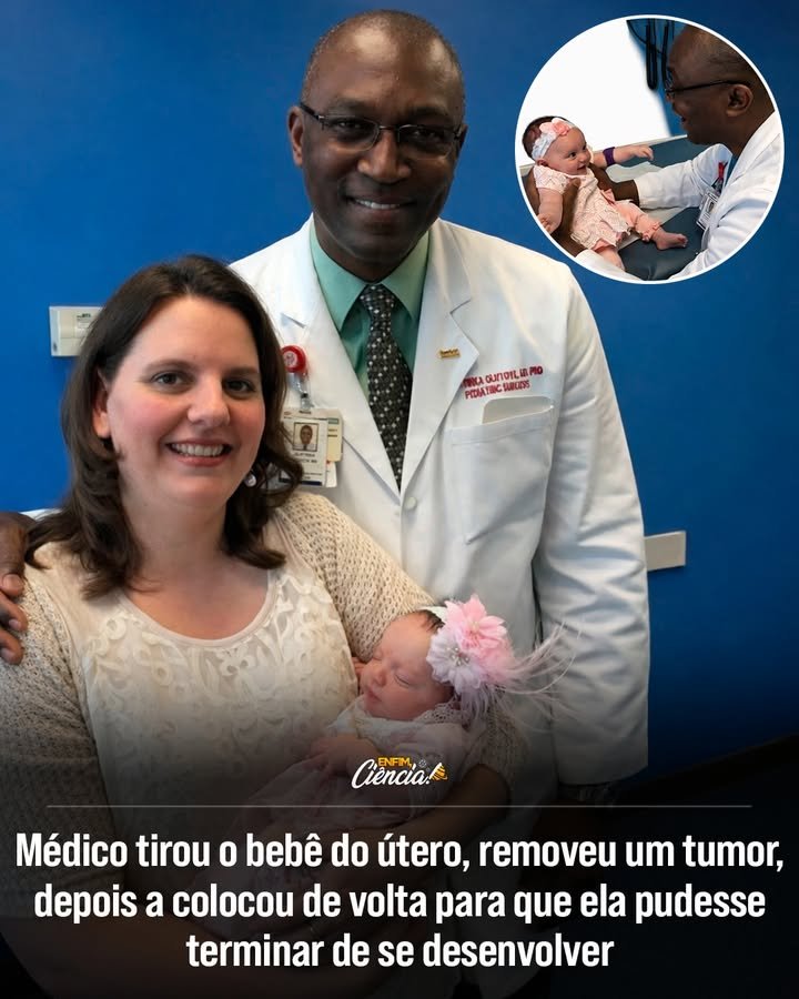 Como os médicos descobriram o tumor no bebê ainda no útero? Durante um exame de rotina, os médicos identificaram um tumor grande e perigoso no feto, que estava drenando seu sangue e sobrecarregando o coração. Por que o tumor era tão perigoso para o feto? O tumor estava drenando o sangue do feto, forçando o coração a trabalhar sob pressão intensa, o que poderia levar a complicações fatais. Quais eram as chances de sobrevivência se esperassem até o nascimento? As chances de sobrevivência seriam mínimas se a equipe médica esperasse até o nascimento para agir, devido à gravidade da condição. Qual foi a decisão ousada tomada pela equipe médica? A equipe médica decidiu realizar uma cirurgia rara, retirando o bebê parcialmente do útero para remover o tumor e depois recolocá-lo. Como foi realizado o procedimento cirúrgico no feto? Os cirurgiões removeram cuidadosamente o tumor enquanto o bebê estava parcialmente fora do útero, garantindo que a gestação pudesse continuar. Quais os riscos envolvidos nessa cirurgia fetal? O procedimento era extremamente delicado e arriscado, exigindo precisão para evitar danos ao feto e à mãe durante a cirurgia. Qual foi o resultado da cirurgia para o bebê? Treze semanas após a cirurgia, a bebê nasceu com segurança e saudável, surpreendendo a todos com sua recuperação. Como essa cirurgia impactou a medicina fetal? Esse procedimento marcou um avanço na medicina fetal, demonstrando novas possibilidades para salvar vidas ainda no útero. Quais são as implicações futuras dessa cirurgia para a medicina? A cirurgia abre portas para novas abordagens em casos complexos, ampliando os limites do que é possível na medicina fetal. Como a equipe médica se preparou para essa cirurgia complexa? A equipe médica contou com planejamento meticuloso e tecnologia avançada para realizar o procedimento com sucesso. Quais são os desafios enfrentados em cirurgias fetais? Cirurgias fetais são desafiadoras devido à fragilidade do feto e à necessidade de precisão extrema para evitar complicações. Como essa cirurgia pode influenciar futuros tratamentos? O sucesso dessa cirurgia pode inspirar novas técnicas e protocolos para tratar condições complexas em fetos. Qual foi a reação da comunidade médica ao sucesso da cirurgia? A comunidade médica ficou impressionada e esperançosa com as novas possibilidades que esse procedimento trouxe à medicina. Quais são os próximos passos na pesquisa de cirurgia fetal? Pesquisadores podem explorar novas tecnologias e técnicas para melhorar ainda mais a segurança e eficácia de cirurgias fetais. Como essa história pode inspirar outras famílias e médicos? Essa história oferece esperança e inspiração, mostrando que a inovação médica pode superar desafios aparentemente impossíveis.