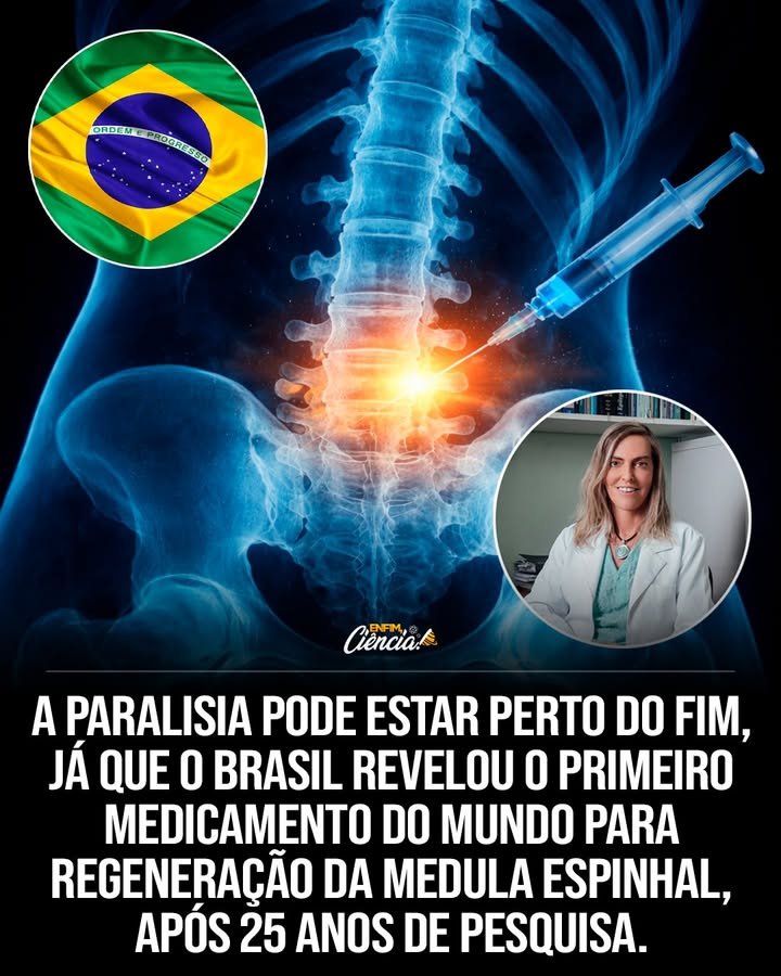 O que é a polilaminina e por que ela é importante? A polilaminina é uma proteína desenvolvida no Brasil, considerada promissora para regenerar vias danificadas da medula espinhal. Ela cria um ambiente favorável à regeneração, estimulando o crescimento de axônios e ajudando neurônios a restabelecer conexões. Como a polilaminina atua na medula espinhal? Ela estimula o crescimento de axônios e ajuda neurônios a restabelecer conexões interrompidas por lesões, criando um ambiente propício à regeneração. Quais são os resultados iniciais dos testes com polilaminina? Testes iniciais mostram que a polilaminina pode reativar células nervosas adormecidas e formar novas conexões neurais. Pacientes relataram melhora na sensibilidade, recuperação parcial de movimentos e maior controle muscular. Os testes com polilaminina são seguros? Até agora, os testes em humanos não mostraram efeitos adversos graves, reforçando o potencial da polilaminina como uma terapia regenerativa promissora. Por que ainda são necessários mais estudos sobre a polilaminina? Estudos em larga escala são necessários para confirmar a eficácia, padronizar doses e entender os efeitos a longo prazo da polilaminina. Qual é o impacto potencial da polilaminina no tratamento da paralisia? Se confirmada eficaz, a polilaminina pode transformar o tratamento da paralisia, oferecendo uma possibilidade real de recuperação funcional para milhões de pessoas. Como a polilaminina pode mudar a abordagem atual de tratamento de lesões na medula espinhal? Ela pode mudar o foco de apenas adaptação e controle de sintomas para uma recuperação funcional real, algo antes considerado impossível. Qual é o próximo passo para a pesquisa com polilaminina? O próximo passo é realizar estudos clínicos em larga escala para confirmar os resultados iniciais e explorar o potencial completo da polilaminina. Quais são os desafios enfrentados pelos pesquisadores da polilaminina? Os desafios incluem confirmar a eficácia em larga escala, padronizar doses e entender os efeitos a longo prazo do tratamento. Como a polilaminina se compara a outras abordagens de tratamento? Ela é considerada uma das abordagens mais promissoras já testadas, com potencial para oferecer recuperação funcional, ao contrário de tratamentos focados apenas em reabilitação e controle de sintomas. Qual é a importância dos ensaios clínicos controlados para a polilaminina? Eles são cruciais para avaliar a segurança e a resposta biológica ao tratamento, garantindo que a polilaminina seja uma opção viável e segura. O que os especialistas dizem sobre a polilaminina? Especialistas estão animados, mas alertam que mais estudos são necessários para confirmar os resultados e entender completamente o potencial da polilaminina. Como a polilaminina pode impactar a vida de pessoas com lesões na medula espinhal? Ela pode oferecer uma chance de recuperação funcional, melhorando a qualidade de vida e a independência de milhões de pessoas afetadas por lesões na medula espinhal. Quando podemos esperar que a polilaminina esteja disponível como tratamento? Ainda não há uma previsão exata, pois depende dos resultados de estudos em larga escala e da aprovação regulatória.