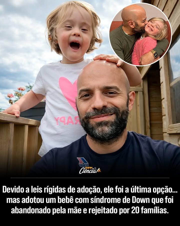 Por que as leis de adoção na Itália são tão rígidas? As leis italianas priorizam casais casados e heterossexuais, dificultando a adoção por solteiros e LGBTQ+. Isso visa garantir um ambiente familiar tradicional, mas limita as oportunidades para muitos potenciais pais adotivos. Como Luca enfrentou as barreiras legais para adoção? Luca, sendo solteiro e gay, foi informado de que suas chances eram quase nulas. Ele só poderia adotar crianças com "problemas graves de saúde" ou "necessidades especiais", rejeitadas por outros. Quem é Alba e por que foi rejeitada por outros casais? Alba, com menos de um mês, foi abandonada pela mãe biológica e recusada por 20 casais devido à síndrome de Down. Muitos viam isso como um "fardo", mas Luca a aceitou imediatamente. Como foi o encontro de Luca com Alba? Luca não hesitou ao saber de Alba. Correu para o hospital e a pegou nos braços, iniciando uma jornada de amor e aceitação que transformaria suas vidas para sempre. Qual é a relação atual entre Luca e Alba? Hoje, Luca e Alba são inseparáveis. Eles formam uma família amorosa e dedicada, desafiando normas sociais e mostrando que o amor não tem barreiras. Como Luca contribui para a normalização de famílias não tradicionais? Luca escreveu livros sobre sua vida com Alba, promovendo a inclusão de pessoas com deficiência e famílias não tradicionais. Ele busca inspirar outros a verem além das convenções. Por que Luca diz que Alba o salvou? Luca acredita que Alba o salvou de uma vida sem propósito. Ela trouxe amor e significado, mostrando que a verdadeira família é construída com amor e aceitação. Quais são os desafios enfrentados por Luca e Alba? Apesar do amor, enfrentam preconceitos sociais e desafios diários relacionados à síndrome de Down. Luca trabalha para superar barreiras e garantir uma vida plena para Alba. Como a história de Luca e Alba impacta a sociedade? A história deles desafia normas e inspira mudanças nas percepções sobre adoção, deficiência e famílias não tradicionais, promovendo maior aceitação e inclusão. O que podemos aprender com a jornada de Luca e Alba? A história deles ensina que o amor verdadeiro transcende barreiras sociais e legais. Mostra a importância da aceitação e do compromisso em construir uma família baseada no amor. Como a experiência de Luca pode influenciar mudanças nas leis de adoção? Ao compartilhar sua história, Luca pode inspirar debates sobre a necessidade de leis mais inclusivas, que considerem o amor e a capacidade de cuidar, acima de convenções tradicionais. Qual é o papel da sociedade na inclusão de famílias como a de Luca e Alba? A sociedade deve promover a aceitação e inclusão, reconhecendo que famílias vêm em diversas formas e que o amor é o elemento mais importante na criação de uma criança. Como Luca e Alba inspiram outras pessoas? Eles mostram que a verdadeira família é construída com amor, aceitação e compromisso, inspirando outros a desafiar normas e abraçar a diversidade em suas próprias vidas.