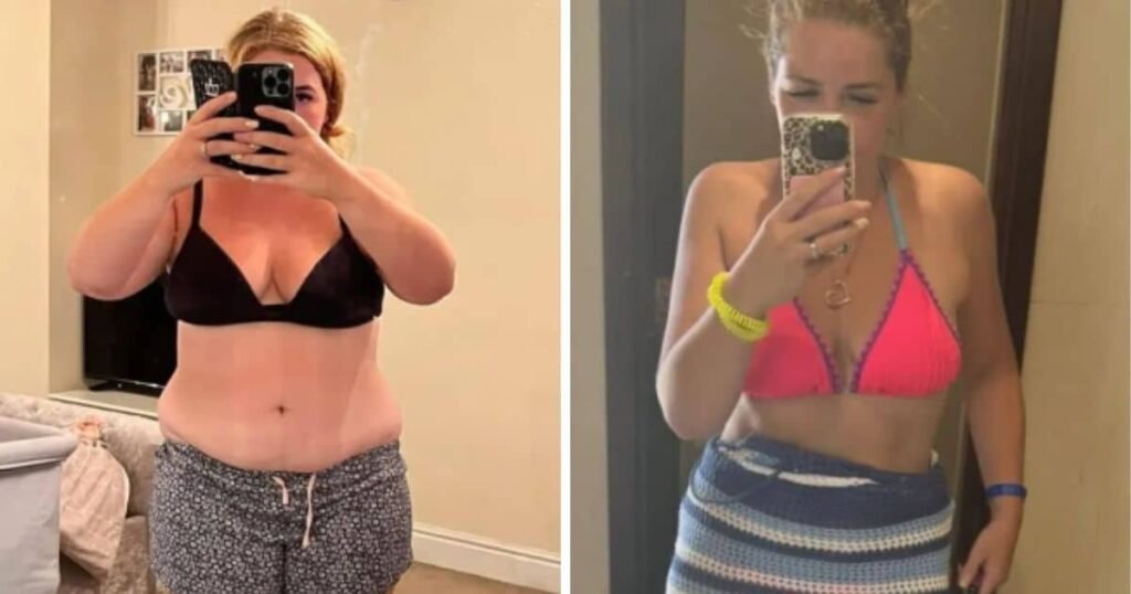 Como Abbie Lodge conseguiu perder 20 kg em apenas quatro meses? Abbie Lodge, mãe de dois filhos, eliminou 20 kg em quatro meses ao fazer mudanças simples na rotina, sem dietas radicais. A principal alteração foi substituir refrigerantes por água, consumindo de 3 a 4 litros diariamente. Qual foi o ponto de virada na jornada de Abbie? O ponto de virada foi a troca de refrigerantes por água. Abbie consumia litros de refrigerante por dia e, ao mudar para água, seu corpo respondeu rapidamente, iniciando a transformação. Como a alimentação de Abbie mudou durante esse período? Abbie adotou uma alimentação mais estruturada, sem extremismos. Ela não proibiu alimentos, mas aprendeu a manter o controle, o que foi essencial para resultados sustentáveis. Qual o papel da atividade física na transformação de Abbie? A prática de atividade física entrou na rotina de Abbie, mas sem exageros. O objetivo era criar um estilo de vida mais saudável e ativo, não compensar excessos. Qual foi a maior transformação que Abbie experimentou? Embora a perda de peso tenha sido significativa, Abbie afirma que a maior transformação foi na saúde mental. A mudança de hábitos impactou positivamente seu bem-estar emocional. Por que a história de Abbie Lodge é tão inspiradora? A história de Abbie destaca que não é preciso recorrer a soluções mágicas ou extremas. Pequenas mudanças nos hábitos podem gerar grandes resultados, tanto físicos quanto mentais. Quais lições podemos aprender com a experiência de Abbie? A experiência de Abbie ensina que antes de buscar métodos extremos, vale olhar para hábitos básicos. Muitas vezes, a chave para uma transformação real e duradoura está em ajustes simples. Como a mudança de hábitos pode impactar a saúde mental? Mudanças de hábitos, como as de Abbie, podem melhorar a saúde mental ao promover um estilo de vida mais equilibrado e reduzir o estresse associado a dietas restritivas. Por que é importante evitar dietas radicais? Dietas radicais podem ser insustentáveis e prejudiciais à saúde. Abbie mostrou que ajustes simples e consistentes são mais eficazes e benéficos a longo prazo. Como a história de Abbie pode inspirar outras mães? A história de Abbie é um exemplo de que é possível conciliar a rotina corrida de mãe com hábitos saudáveis, sem recorrer a métodos extremos, inspirando outras mães a fazerem o mesmo. Quais são os benefícios de substituir refrigerantes por água? Substituir refrigerantes por água ajuda na hidratação, reduz a ingestão de calorias vazias e pode acelerar a perda de peso, como demonstrado pela experiência de Abbie. Como manter o controle alimentar sem proibições? Manter o controle sem proibições envolve equilíbrio e consciência alimentar, permitindo-se comer de tudo com moderação, o que evita a sensação de privação e facilita a adesão ao plano. Qual é a importância de criar um estilo de vida saudável e ativo? Criar um estilo de vida saudável e ativo promove bem-estar físico e mental, reduz o risco de doenças e melhora a qualidade de vida, como evidenciado pela jornada de Abbie. Como pequenas mudanças podem gerar grandes resultados? Pequenas mudanças, como a troca de refrigerantes por água, podem ter um impacto significativo na saúde e no bem-estar, mostrando que transformações não precisam ser radicais para serem eficazes. Por que é importante olhar para hábitos básicos antes de buscar soluções extremas? Focar em hábitos básicos pode revelar áreas de melhoria que são sustentáveis e eficazes, evitando o desgaste físico e emocional associado a soluções extremas.