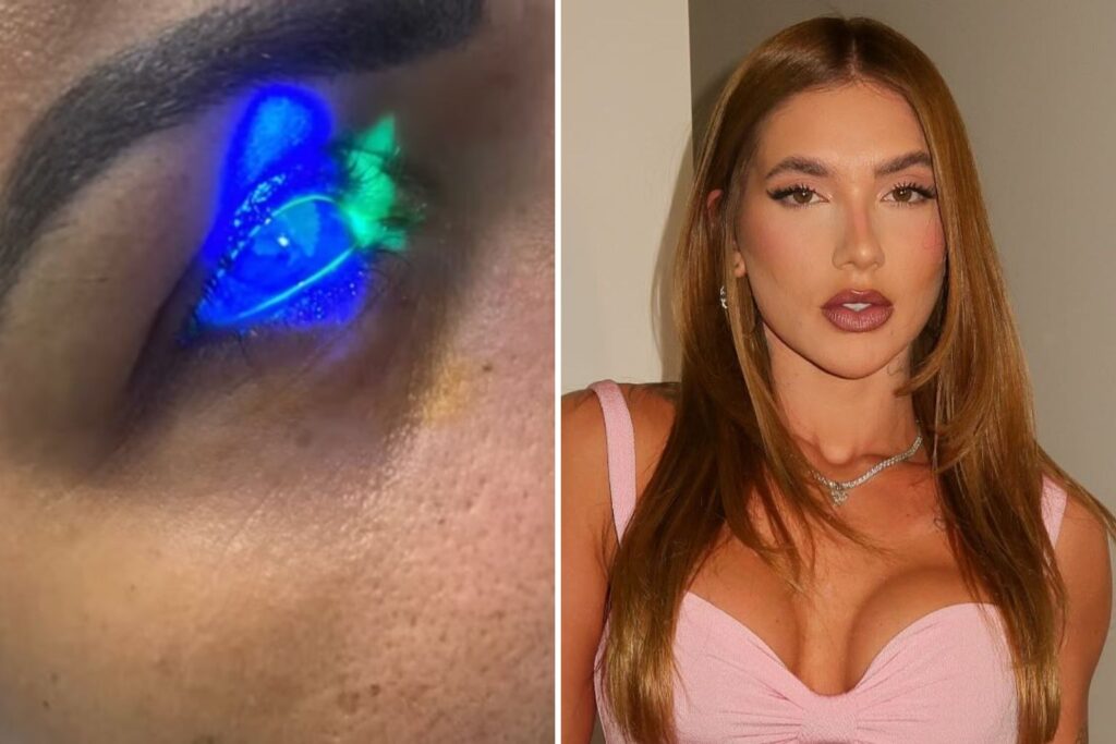 Uma **moradora de Nova Iguaçu**, no Rio de Janeiro, relatou ter perdido a visão após utilizar um **fortalecedor de cílios** da marca **Wepink**, de **Virginia Fonseca**. Este incidente trouxe à tona preocupações sobre a segurança de produtos cosméticos e a necessidade de regulamentações mais rigorosas no setor. A consumidora, que não teve seu nome divulgado, afirmou que o uso do produto resultou em uma reação adversa severa, culminando na perda de visão. O caso gerou grande repercussão nas redes sociais e na mídia, levantando questões sobre a eficácia e segurança dos produtos de beleza disponíveis no mercado. A **Wepink**, marca associada à influenciadora digital Virginia Fonseca, é conhecida por sua linha de cosméticos que promete resultados rápidos e eficazes. No entanto, este incidente destaca a importância de testes rigorosos e da transparência na comunicação dos possíveis efeitos colaterais dos produtos. A segurança dos cosméticos é uma preocupação crescente entre os consumidores, especialmente quando se trata de produtos aplicados em áreas sensíveis, como os olhos. O fortalecimento dos cílios é uma prática comum, mas requer produtos que sejam dermatologicamente testados e aprovados por órgãos reguladores. A falta de regulamentação adequada pode resultar em produtos que não atendem aos padrões de segurança necessários, colocando em risco a saúde dos consumidores. A situação também levanta a questão da responsabilidade das influenciadoras digitais na promoção de produtos. Virginia Fonseca, como figura pública e empreendedora, possui uma grande base de seguidores que confiam em suas recomendações. Este incidente ressalta a importância de as influenciadoras garantirem que os produtos que promovem sejam seguros e eficazes, além de estarem cientes das implicações legais e éticas de suas recomendações. Além disso, o caso sublinha a necessidade de os consumidores estarem atentos às informações fornecidas nas embalagens dos produtos e buscarem avaliações e opiniões de outros usuários antes de realizar uma compra. A leitura atenta dos rótulos e a pesquisa sobre a reputação da marca podem ajudar a evitar experiências negativas. A repercussão deste incidente pode levar a uma revisão das práticas de segurança e regulamentação no setor de cosméticos, incentivando as empresas a investirem mais em pesquisa e desenvolvimento para garantir a segurança de seus produtos. A transparência na comunicação dos ingredientes e dos possíveis efeitos adversos é essencial para construir a confiança do consumidor. Em resumo, o relato da moradora de Nova Iguaçu serve como um alerta para a indústria de cosméticos e para os consumidores. A segurança deve ser uma prioridade, e todos os envolvidos, desde fabricantes até influenciadores, têm um papel crucial na garantia de que os produtos sejam seguros e eficazes. Este incidente pode ser um ponto de inflexão para melhorias nas práticas de segurança e regulamentação, beneficiando tanto os consumidores quanto a indústria como um todo.