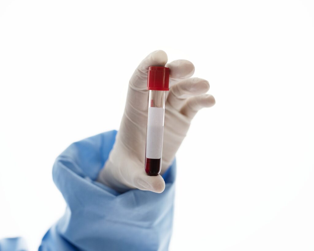 As **Testemunhas de Jeová** introduziram uma atualização significativa em suas diretrizes internas relacionadas a procedimentos médicos que envolvem **transfusão de sangue**. De acordo com a publicação da Revista Oeste, a nova orientação permite que os membros da religião utilizem seu próprio sangue em determinadas circunstâncias clínicas. Esta mudança representa um ajuste importante na prática médica dos fiéis, autorizando procedimentos em que o sangue do paciente é retirado, armazenado e posteriormente reinfundido durante cirurgias que são planejadas com antecedência. Essa atualização reflete uma abordagem mais flexível em relação ao uso do sangue, mantendo, no entanto, os princípios fundamentais da fé. Historicamente, as **Testemunhas de Jeová** têm uma posição firme contra a transfusão de sangue, baseada em sua interpretação de passagens bíblicas que proíbem o consumo de sangue. No entanto, segundo a Revista Oeste, a nova diretriz demonstra uma evolução na compreensão e aplicação dessas crenças, permitindo que os fiéis façam uso de técnicas médicas modernas que respeitam suas convicções religiosas. A possibilidade de armazenar e reinfundir o próprio sangue durante procedimentos cirúrgicos planejados oferece uma alternativa que pode salvar vidas, ao mesmo tempo em que respeita os princípios religiosos. Esta mudança pode ter um impacto significativo na forma como os membros da religião abordam questões de saúde e tratamento médico. A atualização das regras sobre transfusão de sangue pelas **Testemunhas de Jeová** é um exemplo de como as práticas religiosas podem evoluir em resposta a avanços médicos e necessidades práticas. Segundo a publicação, essa decisão pode facilitar o diálogo entre profissionais de saúde e pacientes que são Testemunhas de Jeová, promovendo um entendimento mútuo e respeito pelas escolhas pessoais em contextos médicos. Ao permitir o uso do próprio sangue em situações específicas, a nova diretriz não apenas alinha práticas médicas com crenças religiosas, mas também destaca a importância de soluções inovadoras que conciliem fé e ciência.