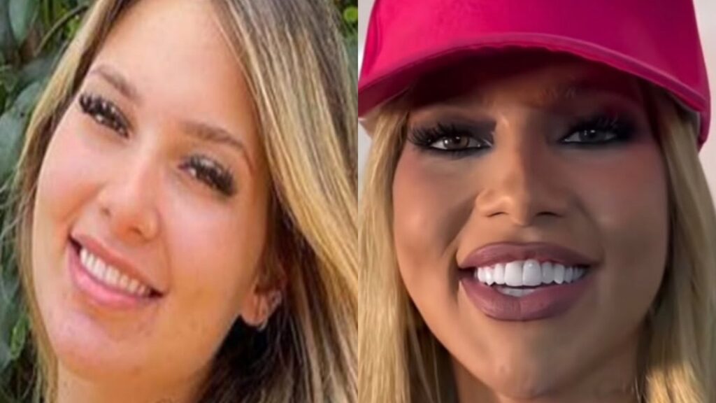 **Virgínia Fonseca**, uma das influenciadoras digitais mais conhecidas do Brasil, tem chamado atenção nas redes sociais devido às mudanças visíveis em seu rosto. Segundo a publicação do jornal O Globo, essas transformações são resultado de uma combinação de tratamentos estéticos e cuidados intensivos com a pele. A influenciadora comentou sobre a repercussão que suas fotos de "antes e depois" geraram, destacando que as alterações são parte de um processo planejado e consciente para melhorar sua aparência e bem-estar. De acordo com especialistas consultados pela publicação, os tratamentos que Virgínia Fonseca tem realizado incluem procedimentos como preenchimentos faciais, aplicação de toxina botulínica e técnicas avançadas de rejuvenescimento da pele. Esses métodos são amplamente utilizados para suavizar linhas de expressão, aumentar o volume em áreas específicas do rosto e melhorar a textura da pele. Além disso, a influenciadora também segue uma rotina rigorosa de cuidados diários, que inclui o uso de produtos específicos para hidratação e proteção solar, essenciais para manter os resultados dos procedimentos estéticos. A repercussão nas redes sociais sobre as mudanças no rosto de Virgínia Fonseca reflete um interesse crescente do público por tratamentos estéticos e cuidados com a pele. Segundo o site de O Globo, a influenciadora tem sido transparente sobre os procedimentos que realiza, o que contribui para desmistificar o uso de técnicas estéticas e incentivar o autocuidado. Essa abordagem aberta e informativa ajuda a educar seus seguidores sobre as possibilidades e limitações dos tratamentos disponíveis, promovendo uma visão mais realista e consciente sobre a busca por melhorias na aparência pessoal.