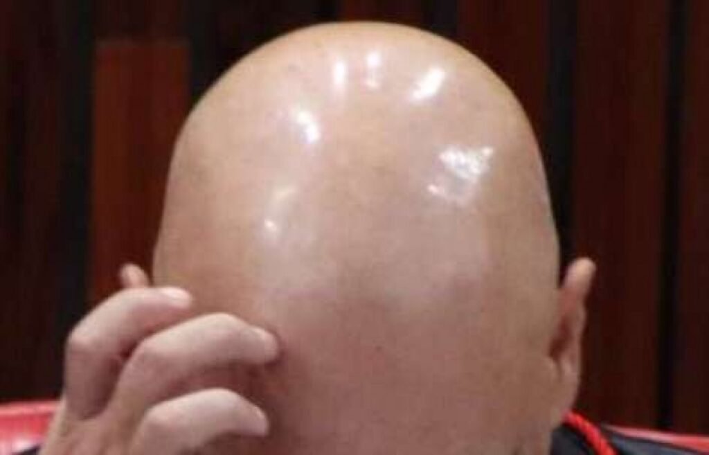 Bastou uma consulta a **matrículas registradas em cartórios do país** para revelar uma **imensa fortuna** atribuída a um mero servidor público. Mas como isso veio à tona? A resposta está em uma apuração divulgada pelo jornal **O Estado de S. Paulo** nesta segunda-feira, dia **6**, com base em um levantamento restrito ao que está formalmente registrado no Brasil. E o que exatamente foi investigado? Foram rastreadas apenas **propriedades formalmente escrituradas** em nome do investigado dentro do território nacional. Isso significa que o trabalho se concentrou no patrimônio imobiliário que aparece de forma oficial nos registros de cartório. Nada além disso entrou no escopo inicial. Então o levantamento mostrou tudo o que existe? Não. Esse é justamente o ponto que torna a descoberta ainda mais significativa. A metodologia adotada não alcançou **bens localizados fora do Brasil**, nem **investimentos realizados em outros países**. Também ficaram de fora **ativos financeiros mantidos em instituições estrangeiras**. Se tanta coisa ficou de fora, por que a apuração chama atenção? Porque, mesmo limitada ao que pôde ser encontrado em registros formais no país, ela já localizou uma fortuna de grandes proporções. E o que isso sugere? Sugere que o patrimônio identificado pode não representar a totalidade dos bens, mas apenas uma parte daquilo que existe. E por que essa limitação importa tanto? Porque um levantamento desse tipo, por sua própria natureza, identifica somente o que está **formalmente escriturado** e acessível em cartórios brasileiros. Se houver patrimônio em outras jurisdições, aplicações fora do país ou imóveis adquiridos no exterior, isso não aparece nesse recorte. Isso quer dizer que houve verificação internacional? Não. **Propriedades adquiridas no exterior não foram verificadas**. Da mesma forma, o trabalho não incluiu a busca por recursos mantidos em bancos estrangeiros ou por outros ativos financeiros fora das fronteiras nacionais. O retrato obtido, portanto, é parcial por definição. Então por que falar em algo maior? Porque, diante do que já foi encontrado apenas com consultas internas e documentais, surge uma pergunta inevitável: se o recorte foi tão limitado e ainda assim revelou tanto, o que poderia aparecer em uma investigação mais ampla? A resposta não foi dada pela apuração, mas o próprio alcance reduzido do levantamento ajuda a explicar a expressão que acompanha o caso. Qual expressão resume essa percepção? **A ponta do iceberg**. E por quê? Porque o patrimônio imobiliário identificado corresponde somente ao que está registrado em cartórios do Brasil, sem incluir bens no exterior, investimentos internacionais ou ativos financeiros mantidos fora do país. O que, então, foi efetivamente confirmado? Foi confirmado que **O Estado de S. Paulo** identificou o **patrimônio imobiliário** de um mero servidor público por meio de uma apuração divulgada na segunda-feira, **6**, baseada em consulta de **matrículas registradas em cartórios do país**. O levantamento se restringiu a **propriedades formalmente registradas no Brasil**. Não abrangeu **bens localizados fora do território nacional**, nem **investimentos realizados em outros países**. Também não incluiu **ativos financeiros mantidos em instituições estrangeiras**, nem verificou **propriedades adquiridas no exterior**. Ainda assim, uma **imensa fortuna** foi localizada. E é exatamente por isso que a definição surge com força no fim: pode ser apenas **a ponta do iceberg**.