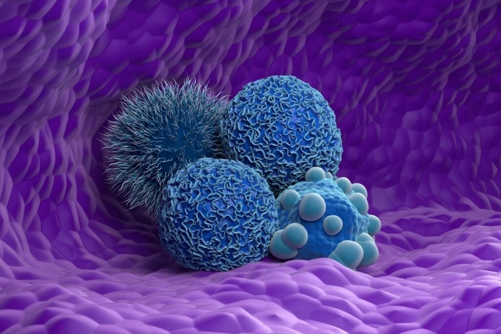 A gordura presente na alimentação pode estar ligada a uma mudança silenciosa e preocupante no comportamento do **câncer de mama**. Mas de que mudança se trata? Segundo um estudo conduzido por pesquisadores da **Universidade de Princeton**, nos Estados Unidos, dietas ricas em gordura podem tornar alguns tumores mais **agressivos**, especialmente no caso do **câncer de mama triplo negativo**, uma forma considerada mais difícil de tratar por não responder à maioria das terapias convencionais. Isso significa que a gordura faz o tumor crescer mais rápido? Não exatamente. Os resultados indicam que a gordura não necessariamente acelera o crescimento do tumor. Então qual foi o efeito observado? Os cientistas identificaram alterações na **estrutura** dos tumores que podem favorecer a invasão de tecidos próximos, um comportamento associado à progressão da doença. Como os pesquisadores chegaram a essa conclusão? Para investigar a influência dos nutrientes, eles cultivaram tumores em um **modelo tridimensional**, desenvolvido para reproduzir de forma mais fiel o ambiente do corpo humano. E por que isso importa? Porque esse tipo de sistema permite observar com mais precisão como o tumor reage a diferentes condições metabólicas, algo que modelos mais simples nem sempre conseguem mostrar. O que foi testado nesse ambiente? Os pesquisadores adicionaram um **plasma semelhante ao humano** com diferentes combinações de nutrientes, simulando condições associadas a várias dietas. E o que aconteceu quando os tumores foram expostos a altos níveis de **ácidos graxos** e **colesterol**? Nessa situação, eles desenvolveram **projeções alongadas** que se estendiam para fora do núcleo do tumor. Por que essas projeções chamaram atenção? Porque essas estruturas estão associadas ao comportamento **invasivo** do câncer e podem facilitar sua disseminação pelo organismo. Em vez de permanecerem compactas, como em condições de referência, as células passaram a apresentar uma forma que sugere maior capacidade de avançar sobre os tecidos ao redor. Esse efeito apareceu com qualquer tipo de nutriente? Não. Outras condições também foram avaliadas, incluindo ambientes ricos em **insulina**, **glicerol** ou **cetonas**. E o resultado foi o mesmo? Não. Nesses casos, os tumores não apresentaram a mesma alteração estrutural. As células permaneceram mais compactas, em um padrão semelhante ao observado na condição de referência. Houve alguma pista biológica para explicar essa diferença? Sim. Os cientistas observaram mudanças na atividade de um gene chamado **MMP1**. O que esse gene faz? Ele está associado à **degradação do colágeno**, componente importante dos tecidos ao redor do tumor. E qual foi a relação encontrada? O aumento da expressão de **MMP1** apareceu fortemente ligado às alterações estruturais vistas nas células expostas à gordura. O que isso pode indicar? A hipótese levantada pelos pesquisadores é que dietas ricas em gordura possam estimular esse mecanismo, facilitando a degradação do ambiente ao redor do tumor e favorecendo seu avanço. Isso já prova uma relação direta de causa e efeito? Ainda não. Os próprios cientistas ressaltam que essa relação ainda precisa ser confirmada em **estudos futuros**. E a chamada **dieta cetogênica** entrou na análise? Sim. Os experimentos também testaram uma mistura de nutrientes projetada para simular esse padrão alimentar, caracterizado por alto consumo de gordura e baixa ingestão de carboidratos. Houve melhora em relação aos tumores iniciais? Não. Nesse modelo, não foi observada melhora. Então o que esse estudo acrescenta? Ele sugere que entender a interação entre **dieta** e **microambiente tumoral** pode ajudar a identificar novos alvos para pesquisas sobre o comportamento do câncer e possíveis estratégias terapêuticas. Os resultados foram publicados na revista científica **APL Bioengineering** em **3 de março**. E a informação que permanece no centro de tudo é esta: no modelo analisado, altos níveis de **ácidos graxos** e **colesterol** estiveram associados a mudanças estruturais ligadas a maior **invasão tumoral** no **câncer de mama triplo negativo**, sem evidência de aceleração direta do crescimento do tumor.