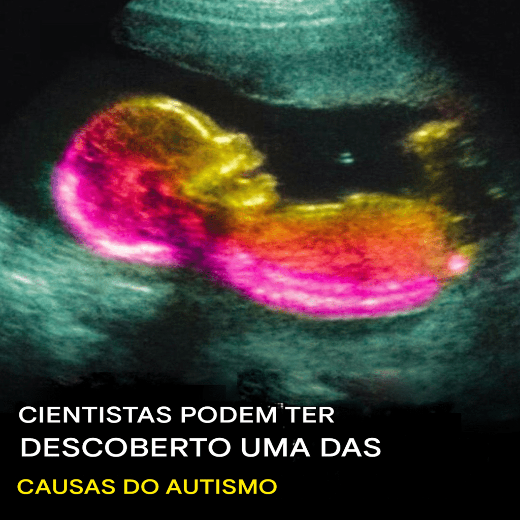 É verdade que o autismo encontra parte de sua origem no útero da mãe?