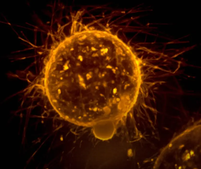 Sinais de câncer: 3 dores persistentes que o corpo usa como alerta silencioso