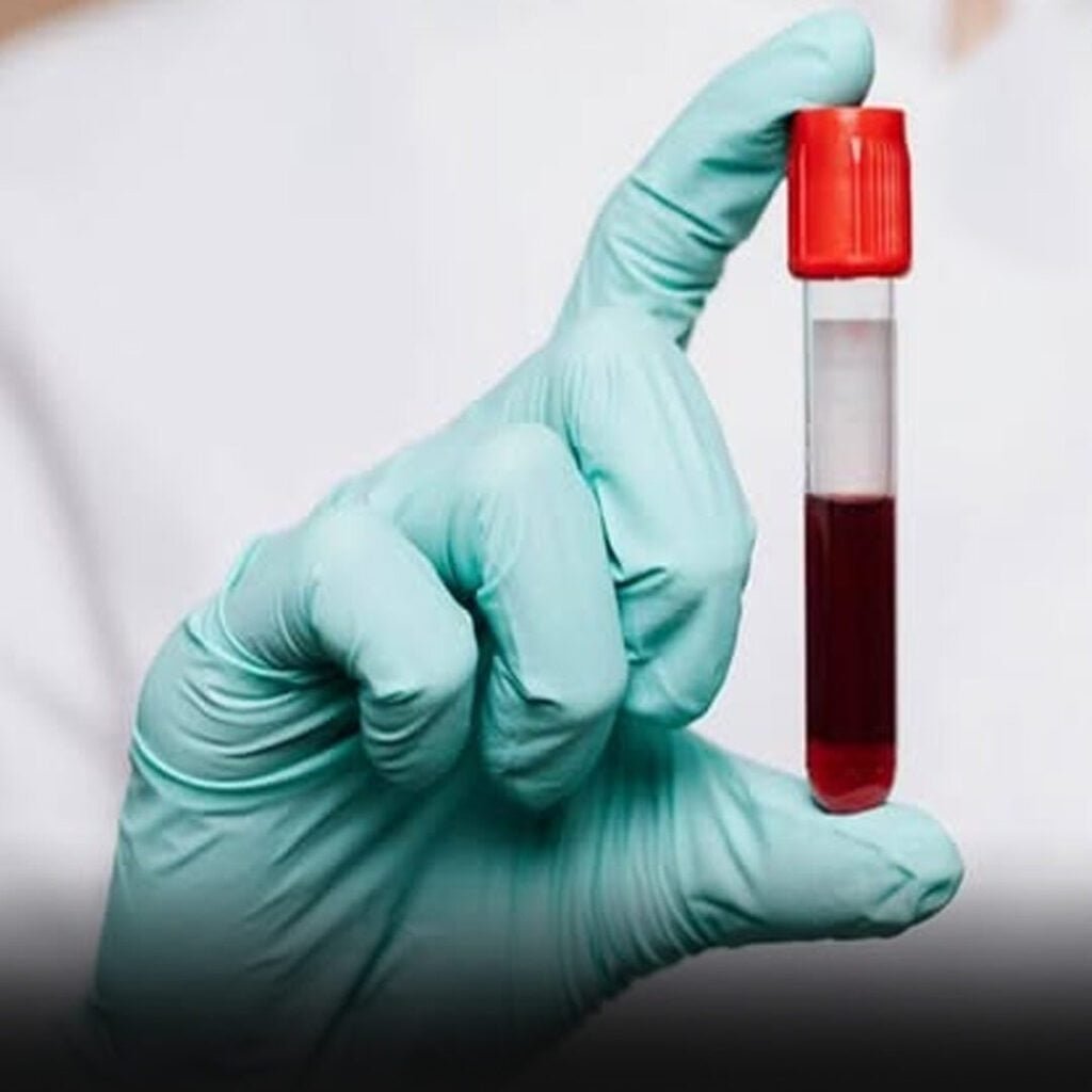 Seu tipo sanguíneo pode influenciar no envelhecimento? O que a ciência já descobriu