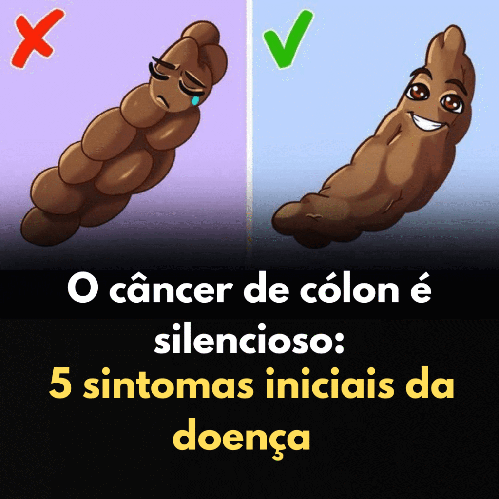 O câncer de cólon é silencioso: 5 sintomas iniciais da doença