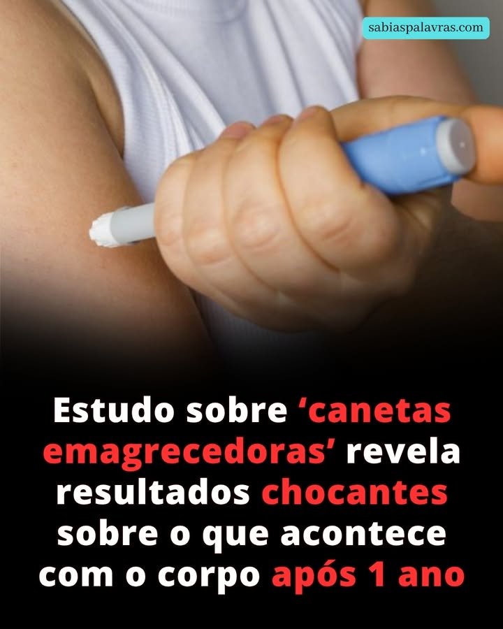 Estudo sobre ‘canetas emagrecedoras’ revela resultados chocantes sobre o que acontece com o corpo após 1 ano