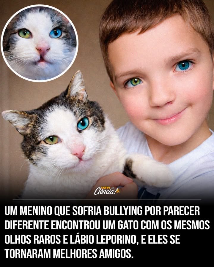 Às vezes, tudo o que uma criança precisa para voltar a sorrir é encontrar, no lugar mais improvável possível, alguém que carregue exatamente as mesmas marcas que o mundo usou para machucá-la. Mas como algo assim poderia acontecer de forma tão precisa? Como alguém que já estava ferido por dentro, por se sentir diferente todos os dias, encontraria justamente um companheiro com as mesmas características que o tornavam alvo de comentários cruéis? A resposta parece simples à primeira vista, mas carrega uma força emocional muito maior do que parece. Antes disso, o que havia acontecido com ele? Havia a dor silenciosa de quem ainda é muito novo para entender por que certas pessoas transformam diferenças em motivo de zombaria. Em vez de verem algo único, algumas crianças enxergavam apenas aquilo que fugia do padrão. E isso foi abalando sua **confiança**, pouco a pouco, até atingir algo ainda mais delicado: sua vontade de se mostrar ao mundo como era. Mas por que isso doía tanto? Porque não se tratava apenas de aparência. Quando uma criança começa a acreditar que há algo errado com ela, o impacto vai além de um momento ruim. A mãe percebeu isso claramente. Segundo ela, o bullying parecia ter quebrado o espírito do menino. E é justamente aqui que muita gente se surpreende: a mudança não começou com um grande discurso, nem com uma resposta perfeita para a dor. Começou com uma imagem. Que imagem era essa? Em um grupo online de apoio para pessoas com **lábio leporino**, surgiu a foto de um gato resgatado que precisava de um lar. Até aí, poderia ser apenas mais uma publicação entre tantas. Mas havia um detalhe que quase ninguém esperaria encontrar. O animal tinha **lábio leporino** e **heterocromia**, a condição que faz com que os olhos tenham cores diferentes. E por que isso chamou tanta atenção? Porque o menino também havia nascido com **lábio leporino bilateral** e **heterocromia**. Um olho azul. Um olho verde. De repente, aquilo que antes parecia isolá-lo apareceu refletido em outro ser vivo, de forma quase impossível de ignorar. Não era só semelhança. Era identificação. Mas será que uma coincidência assim realmente poderia mudar alguma coisa? O que acontece depois é o que transforma essa história em algo tão marcante. A família decidiu viajar para conhecer o gato. Não era apenas curiosidade. Havia a sensação de que precisavam ver de perto aquilo que parecia inacreditável demais para ficar só na tela. E quando eles se encontraram, o que houve? A conexão foi imediata. O gato, depois chamado de **Moon**, foi levado para casa. Desde o primeiro momento, a impressão era de que os dois estavam destinados a se encontrar. E isso levanta uma pergunta ainda mais forte: por que esse encontro significou tanto? Porque Moon não era apenas um animal de estimação. Ele se tornou um espelho afetivo. Um lembrete vivo de que aquilo que fazia o menino se sentir sozinho não precisava ser escondido. Pelo contrário. Podia ser visto com ternura, acolhimento e até beleza. E aqui está o ponto que muda tudo: quando alguém encontra identificação sem julgamento, a dor começa a perder espaço. Mas essa amizade realmente teve impacto? Segundo a mãe, sim. Ela ajudou o filho a perceber que suas diferenças não eram algo vergonhoso. Aquilo que antes parecia um peso passou a ser entendido de outra forma. Não como defeito, mas como parte de quem ele é. E isso, para uma criança que havia sido machucada justamente por parecer diferente, tem um valor impossível de medir com exatidão. Então o que torna essa história tão forte? Não é apenas o fato de um menino e um gato terem características raras em comum. É o que essa semelhança representou. Em vez de reforçar a sensação de exclusão, ela trouxe pertencimento. Em vez de lembrar a dor, abriu espaço para aceitação. E no fim, o que fica? Fica a imagem de dois seres que, de algum modo, se reconheceram. Fica a ideia de que ser **diferente** não é algo que precisa ser corrigido para merecer amor. E fica também uma pergunta que continua ecoando depois da última linha: quantas pessoas ainda estão esperando encontrar, em alguém ou em algum lugar, a prova de que nunca houve nada de errado com elas?