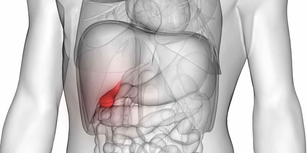 O que acontece após a remoção da vesícula biliar e 3 riscos para observar