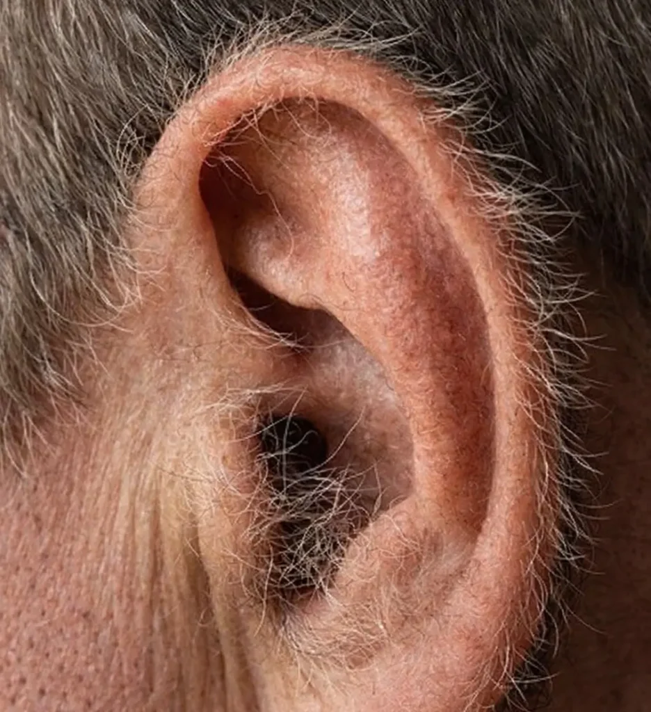 Você sabia? Se crescem pelos nas suas orelhas, é porque o seu corpo está…