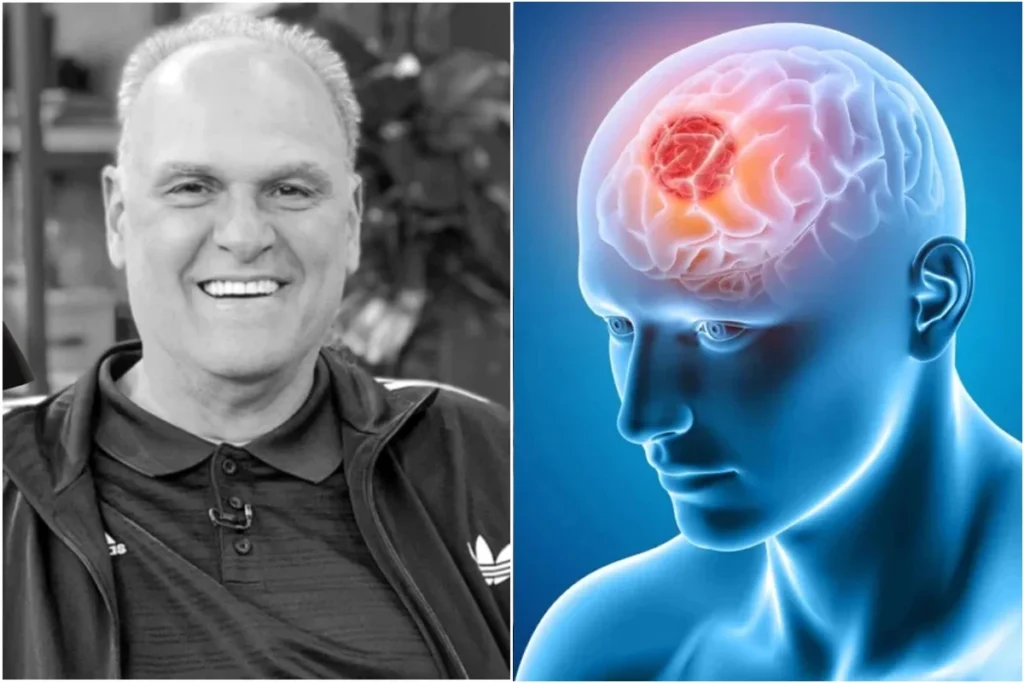 Tudo começou com um mal-estar que parecia passageiro, mas escondia algo que mudaria os 15 anos seguintes. O que poderia haver por trás de um episódio aparentemente comum durante uma viagem? A resposta só apareceu depois que ele foi levado ao hospital e submetido a exames. Foi ali que uma tomografia revelou algo muito maior do que qualquer desconforto momentâneo faria imaginar: um tumor cerebral de grandes proporções. Mas esse foi o momento mais duro de toda a história? Ainda não. Antes disso se transformar em uma longa batalha, veio o primeiro choque. O próprio relato impressiona justamente pela forma direta como tudo surgiu, sem aviso, sem preparação, sem tempo para entender. Ele passou mal nos Estados Unidos, foi examinado, e os médicos encontraram um tumor benigno de 7 centímetros. Se era benigno, então o problema estava resolvido? É aqui que muita gente se surpreende. A retirada do tumor foi apenas o início de um caminho muito mais longo do que parecia. O que parecia ter sido controlado voltaria a assombrá-lo pouco tempo depois, e de uma forma ainda mais preocupante. O que aconteceu em seguida? Dois anos depois, novos exames apontaram outra alteração. E há um detalhe que quase ninguém percebe quando ouve essa história pela primeira vez: o segundo momento de tensão não veio com alarde público imediato, mas com uma ligação médica que já carregava um peso enorme. Ao ouvir que o doutor queria “dar uma palavrinha” quando ele voltasse ao Brasil, a reação foi imediata. Ele mesmo resumiu o pressentimento em poucas palavras: “Lá vem bomba”. E era mesmo? Sim. Dessa vez, foi identificado um tumor maligno de 8 centímetros. O cenário mudou completamente. O que antes já havia sido grave ganhou outra dimensão, exigindo não apenas acompanhamento, mas sessões de quimioterapia e radioterapia ao longo dos anos. Como alguém atravessa tudo isso sem desaparecer da própria história? Essa talvez seja a pergunta que mais prende quem acompanha sua trajetória. Porque, em vez de se resumir ao diagnóstico, ele transformou a doença em mais um capítulo de resistência. Mesmo diante de um tratamento pesado, seguiu falando sobre a condição com força e até bom humor, algo raro em situações tão duras. Mas a luta ficou restrita ao tumor? Não. E esse é outro ponto que reacende a dimensão do que ele enfrentou. Em 2016, ainda lidando com as consequências da doença e do tratamento, ele também teve uma arritmia cardíaca. Ou seja, não se tratava de um único obstáculo isolado, mas de uma sequência de desafios de saúde que se acumulavam com o tempo. Então por que essa história voltou a comover tanta gente agora? Porque sua despedida trouxe símbolos que dizem muito sobre quem ele foi até o fim. Na noite de sexta-feira, 17, a cerimônia de cremação aconteceu de forma restrita, apenas com familiares. O velório também foi mantido longe do público, e o local da cremação não foi divulgado. Tudo seguiu o desejo de discrição manifestado pela família. Mas há um detalhe que dá outro peso a esse adeus. Segundo informação confirmada pelo Jornal da Globo, ele foi cremado vestindo a camisa da seleção brasileira. E o que isso representa? Muito mais do que uma escolha de roupa para a despedida. Representa a ligação profunda com o país e com a trajetória que construiu defendendo o Brasil, inclusive quando recusou a NBA para seguir representando a seleção em competições internacionais. Quem era esse homem por trás da despedida tão simbólica? Oscar Schmidt, o maior nome da história do basquete brasileiro, o “Mão Santa”, alguém cuja imagem sempre esteve ligada às quadras, aos pontos, à seleção e à entrega absoluta ao esporte. Mas o que aconteceu antes do diagnóstico que o acompanhou por 15 anos mostra outro lado de sua grandeza: o instante em que um simples mal-estar revelou uma batalha silenciosa, longa e devastadora. E o que fica quando tudo parece já ter sido dito? Fica justamente o que mais impressiona: não apenas o ídolo que brilhou no esporte, mas o homem que encarou um tumor benigno, depois um maligno, anos de tratamento e outros problemas de saúde sem perder a força de seguir. Só que, quanto mais se olha para essa história, mais ela parece dizer que sua despedida não encerra o impacto que ele deixou.