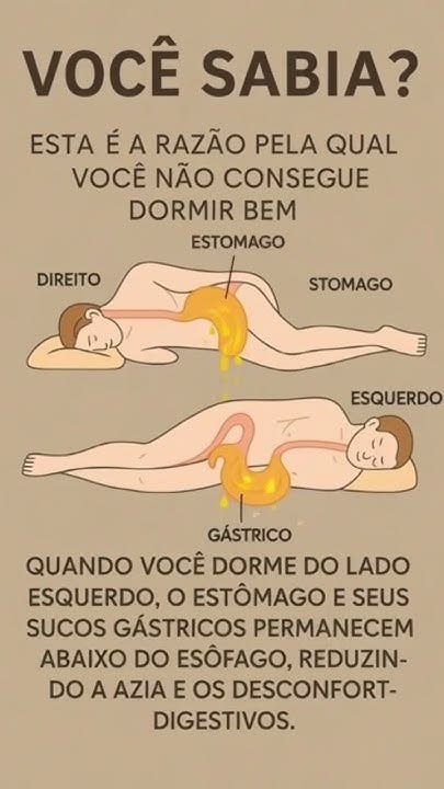 **Você sabia? Esta é a razão pela qual você não consegue dormir bem** Dormir bem é essencial para a saúde física e mental, mas muitas pessoas enfrentam dificuldades para ter uma noite de sono reparadora. **Você sabia** que a posição em que você dorme pode influenciar significativamente a qualidade do seu sono? Vamos explorar como a posição de dormir pode afetar o seu descanso e o que você pode fazer para melhorar isso. **Por que a posição de dormir é importante?** A posição em que você dorme pode impactar diretamente a sua saúde digestiva e a qualidade do sono. Dormir na posição errada pode levar a problemas como **azia**, desconforto digestivo e até mesmo apneia do sono. Mas qual é a posição ideal para dormir e por quê? **Dormir do lado esquerdo: a solução para problemas digestivos** Quando você dorme do lado **esquerdo**, o **estômago** e seus **sucos gástricos** permanecem abaixo do **esôfago**. Isso é importante porque ajuda a reduzir a **azia** e outros desconfortos digestivos. Mas como isso funciona? **Como a gravidade ajuda na digestão?** Dormir do lado esquerdo utiliza a gravidade a seu favor. Nesta posição, o estômago fica em uma posição que impede que os sucos gástricos voltem para o esôfago, o que é uma das principais causas da azia. Isso ocorre porque o estômago está localizado ligeiramente à esquerda do corpo, e dormir deste lado ajuda a manter o conteúdo gástrico no lugar. **Quais são os benefícios de dormir do lado esquerdo?** Além de reduzir a azia, dormir do lado esquerdo pode trazer outros benefícios para a saúde. Esta posição pode melhorar a circulação sanguínea, facilitar a drenagem linfática e até mesmo ajudar na função cardíaca. Dormir do lado esquerdo também pode ser benéfico para mulheres grávidas, pois melhora a circulação para o feto. **E quanto a dormir do lado direito?** Dormir do lado **direito** pode não ser tão benéfico quanto dormir do lado esquerdo, especialmente para pessoas que sofrem de problemas digestivos. Nesta posição, o estômago fica acima do esôfago, o que pode facilitar o refluxo gástrico e aumentar a azia. Portanto, se você tem problemas de digestão, é aconselhável evitar dormir do lado direito. **O que mais pode afetar o sono?** Além da posição de dormir, outros fatores podem afetar a qualidade do sono. A alimentação, o estresse e o ambiente de sono são aspectos importantes a serem considerados. Evitar refeições pesadas antes de dormir, criar uma rotina relaxante e garantir que o quarto esteja escuro e silencioso são práticas que podem melhorar significativamente o sono. **Como posso melhorar minha posição de dormir?** Se você está acostumado a dormir em uma posição que não é ideal, pode ser difícil mudar de hábito. No entanto, algumas dicas podem ajudar: 1. **Use travesseiros**: Colocar um travesseiro entre os joelhos pode ajudar a manter a coluna alinhada e tornar mais confortável dormir do lado esquerdo. 2. **Escolha um colchão adequado**: Um colchão que ofereça suporte adequado pode fazer uma grande diferença na qualidade do sono. 3. **Seja paciente**: Mudar de posição de dormir pode levar tempo, mas com persistência, você pode se acostumar a dormir do lado esquerdo. **Conclusão** Dormir bem é fundamental para a saúde e o bem-estar, e a posição em que você dorme pode desempenhar um papel crucial nisso. Dormir do lado esquerdo pode ajudar a reduzir a azia e melhorar a digestão, além de oferecer outros benefícios para a saúde. Se você está enfrentando dificuldades para dormir, considere ajustar sua posição de dormir e adotar hábitos que promovam um sono de qualidade. Experimente essas dicas e veja como pequenas mudanças podem fazer uma grande diferença na sua vida.