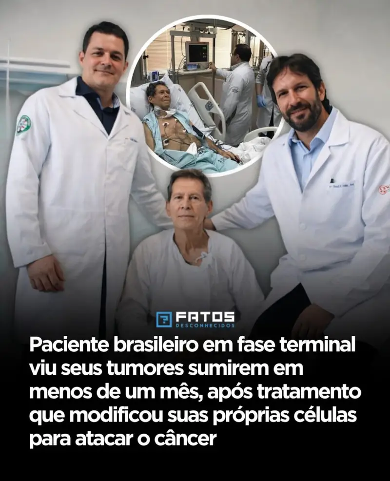 Ele já não tinha mais para onde correr — e foi justamente aí que algo quase impossível começou a acontecer. Como alguém em **fase terminal** pode ver os próprios **tumores sumirem em menos de um mês**? A pergunta parece exagerada, mas não é. Quando os tratamentos disponíveis já não ofereciam resposta, surgiu uma alternativa que parecia tão ousada quanto delicada: usar o próprio corpo como arma contra a doença. E isso, por si só, já levanta outra dúvida inevitável. Como o próprio organismo poderia atacar um câncer que já estava avançado? A resposta está em uma estratégia que vem mudando a forma como a medicina enxerga certos casos graves. Em vez de apenas tentar destruir o tumor com métodos tradicionais, os médicos recorreram a uma abordagem em que **células do próprio paciente** são retiradas e **modificadas em laboratório** para reconhecer e combater o câncer de forma mais precisa. Parece simples quando dito assim, mas há um ponto que quase ninguém percebe. Se as células já estavam no corpo, por que antes elas não conseguiam impedir a doença? Porque o câncer, em muitos casos, encontra maneiras de escapar da vigilância natural do sistema imunológico. Ele avança, se espalha e resiste. É exatamente aí que entra a mudança decisiva: essas células passam por uma reprogramação para voltar ao organismo com uma função muito mais direcionada. E é nesse momento que surge a pergunta que prende tudo. O que aconteceu depois dessa modificação? A resposta surpreendeu até quem acompanhava o caso de perto. Em **menos de um mês**, houve uma **redução drástica das células cancerígenas**. Não se tratou apenas de um resultado em exames. Os **sintomas melhoraram rapidamente**, e houve até **recuperação da mobilidade**. O que acontece depois muda toda a percepção sobre o que parecia irreversível. Mas antes de entender o peso disso, existe algo ainda mais importante. Quem era esse paciente e por que esse caso ganhou tanta atenção? Tratava-se de **Vamberto Luiz de Castro**, um **brasileiro com linfoma em estágio avançado**, que já não tinha mais alternativas de tratamento. Quando a situação parecia ter chegado ao limite, ele se tornou um dos **primeiros pacientes da América Latina** a receber a **terapia CAR-T** em **Ribeirão Preto**. E é aqui que muita gente se surpreende: não foi apenas uma melhora clínica. O caso passou a representar algo maior. Por que esse resultado foi visto como um marco? Porque mostrou, de forma concreta, o potencial da **imunoterapia** no combate ao câncer. A terapia **CAR-T** não age como uma tentativa genérica. Ela usa células do próprio paciente e as transforma em uma resposta direcionada contra a doença. Isso muda a lógica do tratamento e reacende uma pergunta que surge naturalmente no meio de tudo isso. Se funcionou tão rápido, estamos diante de uma virada definitiva? A resposta exige cuidado. O caso mostrou um resultado impressionante, mas o que mais chama atenção é o que ele simboliza: uma nova possibilidade para situações em que quase nada mais parecia viável. E há um detalhe que torna tudo ainda mais forte: esse avanço aconteceu no **Brasil**, com impacto direto na medicina da região. Então o que esse caso realmente revela? Revela que, mesmo em um cenário extremo, a medicina pode abrir caminhos onde antes só havia limite. Um paciente brasileiro, em estado avançado, viu seus tumores regredirem rapidamente após um tratamento que **modificou suas próprias células para atacar o câncer**. Esse é o centro da história. Mas talvez o mais inquietante não seja apenas o que já aconteceu — e sim o que isso ainda pode significar para os próximos casos que hoje parecem sem saída.