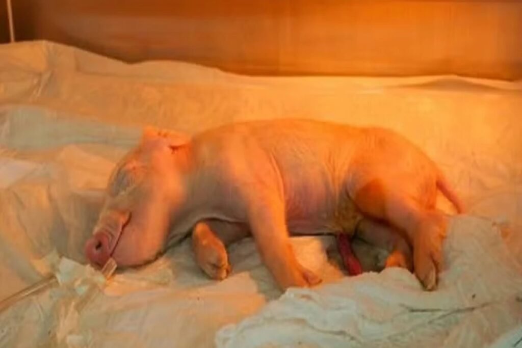 Ele nasceu pequeno, saudável e silencioso, mas pode estar no centro de uma mudança que mexe com uma das maiores urgências da medicina. Como assim um nascimento pode ter tanto peso? Porque não se trata apenas de mais um avanço de laboratório, e sim de um passo que pode alterar o futuro dos transplantes. A pergunta que surge quase imediatamente é simples: o que esse animal tem de tão diferente para chamar tanta atenção? A resposta começa em uma necessidade que o Brasil conhece bem. A fila por órgãos continua sendo um dos maiores desafios da saúde, e qualquer alternativa real para ampliar a oferta desperta interesse imediato. Mas então vem outra dúvida inevitável: seria mesmo possível usar órgãos de um animal em humanos? É justamente aí que entra uma área que há anos provoca expectativa e cautela ao mesmo tempo. O nome técnico é xenotransplante, a transferência de órgãos entre espécies diferentes. Parece algo distante, quase ficção, mas já é estudado em vários países. Só que existe um obstáculo enorme no caminho. Se a ideia parece promissora, por que isso ainda não virou realidade? Porque o corpo humano reage. E reage rápido. O sistema imunológico tende a reconhecer o órgão animal como uma ameaça e pode rejeitá-lo de forma imediata. Esse é o ponto que trava o avanço clínico em larga escala. Só que há um detalhe que quase ninguém percebe: o problema não está apenas no transplante em si, mas em como o animal é preparado muito antes disso. Então o que foi feito de diferente agora? Os cientistas trabalharam para tornar esse animal mais compatível com o organismo humano. Para isso, usaram a ferramenta de edição genética CRISPR/Cas9. Três genes suínos ligados à rejeição foram desativados, e sete genes humanos foram inseridos nas células do animal. Isso não elimina todos os desafios, mas aumenta as chances de que, no futuro, seus órgãos sejam melhor aceitos. Mas por que justamente um porco? Essa é a parte em que muita gente se surpreende. Os suínos são considerados adequados para esse tipo de pesquisa porque seus órgãos têm semelhanças com os humanos em tamanho e funcionamento. Além disso, se reproduzem e crescem rapidamente, o que facilita pensar em escala. E o que acontece depois muda tudo: com cerca de sete meses, esses animais já podem atingir o tamanho adequado para doar órgãos a um adulto. Ainda assim, faltava a peça principal. Onde isso aconteceu e por que esse caso ganhou tanta relevância? O marco foi alcançado no Brasil por cientistas da Universidade de São Paulo, com apoio da FAPESP. O projeto começou em 2019 e resultou no primeiro porco clonado da América Latina com potencial para fornecer órgãos humanos no futuro. O animal nasceu com cerca de 1,7 kg, após quatro meses de gestação, em um laboratório de Piracicaba, no interior de São Paulo. E quais órgãos estão no foco dessa pesquisa? Inicialmente, rim, coração, córnea e pele. Não por acaso. Juntos, eles representam cerca de 94% da demanda por transplantes no SUS. Isso levanta outra questão importante: a proposta seria substituir de vez a doação humana? Não necessariamente. Em muitos casos, a ideia também é servir como ponte até que um órgão humano compatível apareça. Mas existe segurança nisso? Essa preocupação é central. Por isso, os animais são criados sob controle sanitário rigoroso, justamente para reduzir riscos de transmissão de vírus ou bactérias. Mesmo assim, o xenotransplante ainda não é uma realidade clínica aprovada de forma ampla. Estudos seguem em andamento em países como Estados Unidos e China, e alguns resultados experimentais já mostraram órgãos de porco funcionando por meses em pacientes humanos. Então por que esse nascimento importa tanto agora? Porque ele coloca o Brasil dentro de uma corrida científica estratégica. Se essa tecnologia se tornar viável apenas fora do país, depender da importação de órgãos seria algo praticamente inviável para o SUS. E esse é o ponto principal: o Brasil criou seu primeiro porco clonado com potencial para transplante de órgãos humanos, abrindo caminho para tentar reduzir, no futuro, uma fila que hoje custa tempo, esperança e vidas. Só que a parte mais intrigante talvez seja outra. Esse nascimento não resolve o problema ainda. Ele apenas inaugura uma possibilidade que, se avançar, pode mudar a lógica dos transplantes no país. E quando uma possibilidade dessas finalmente deixa de ser teoria, a próxima pergunta deixa de ser se isso importa e passa a ser até onde isso pode chegar.