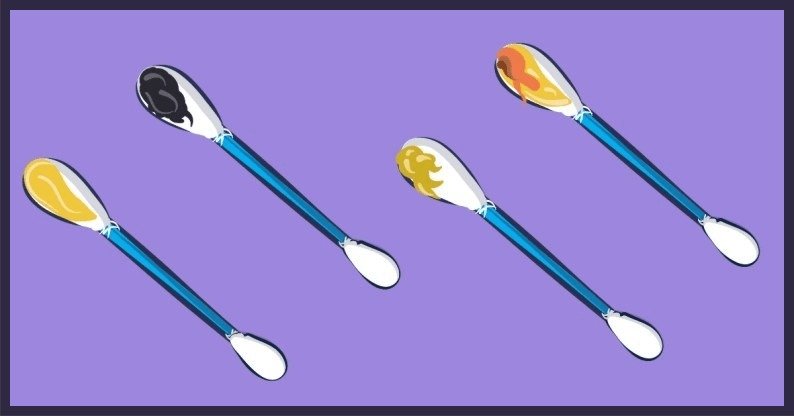 **Seus Ouvidos Podem Dizer Muito Sobre Sua Saúde - Entenda Os Sinais** Você já parou para pensar que seus **ouvidos** podem revelar muito sobre sua saúde? Segundo a publicação, o **cerume** não é apenas uma substância que precisa ser removida regularmente por questões de higiene, mas também um indicador do estado geral do seu organismo. Vamos explorar como a cor e a consistência do cerume podem ser sinais importantes para a sua saúde. **Por que a cor do cerume é importante?** A cor do cerume pode indicar diferentes condições de saúde. Se o seu cerume estiver **acinzentado** e você não apresentar outros sintomas, não há motivo para preocupação. Essa coloração é comum em habitantes de grandes cidades, onde o ar é mais poluído. No entanto, se você notar **manchas de sangue** ao limpar os ouvidos, isso pode ser um sinal de que você perfurou o tímpano, o que pode levar a infecções e até mesmo à **otite**. Nesse caso, é crucial procurar um médico imediatamente. **O que significa cerume marrom ou preto?** Se seus ouvidos produzem uma grande quantidade de cerume **marrom**, isso pode ser um indicativo de que seu corpo passou por um período de **stress**. É aconselhável tentar relaxar e passar alguns dias em um ambiente tranquilo. Por outro lado, se o cerume estiver **preto** e você sentir coceira, pode ser um sinal de **infecção fúngica**, e uma visita ao médico é recomendada. **E se o cerume for branco ou tiver um cheiro desagradável?** O cerume **branco** pode indicar que seu corpo está precisando de **vitaminas** e **microelementos**, especialmente ferro. Introduzir alimentos ricos em ferro, como feijão, aveia e ervilha, em sua dieta pode ajudar. Um cerume com **cheiro desagradável** pode ser sinal de uma infecção no ouvido, especialmente se acompanhado de ruídos e sensação de orelhas bloqueadas. Nesse caso, procurar um médico é essencial. **O que a mudança na consistência do cerume pode indicar?** Alterações na consistência do cerume, como sua descarga do ouvido, podem indicar uma possível lesão do **meato auditivo** e o início de um processo inflamatório. A explicação mais simples para essa mudança pode ser uma deficiência de **gorduras saudáveis** no corpo. Se, após aumentar o consumo de alimentos ricos em gordura, a situação não melhorar, pode ser um sintoma de **dermatite** ou outras doenças de pele. **Qual é a cor ideal do cerume?** A cor ideal do cerume é geralmente **marrom**. No entanto, se o seu cerume for **amarelado**, isso não necessariamente indica um problema. É importante observar outros sintomas e, se necessário, consultar um profissional de saúde. **E se não houver cerume?** Caso você limpe os ouvidos e não encontre cerume, isso pode ser normal para algumas pessoas. No entanto, se essa ausência de cerume for acompanhada de outros sintomas, pode ser necessário investigar mais a fundo com um médico. Em resumo, prestar atenção aos sinais que seus ouvidos estão enviando pode ser uma maneira eficaz de monitorar sua saúde. Se você notar qualquer alteração significativa na cor, consistência ou cheiro do cerume, é sempre uma boa ideia procurar orientação médica. Assim, você pode garantir que seus ouvidos e sua saúde geral estejam sempre em boas condições.