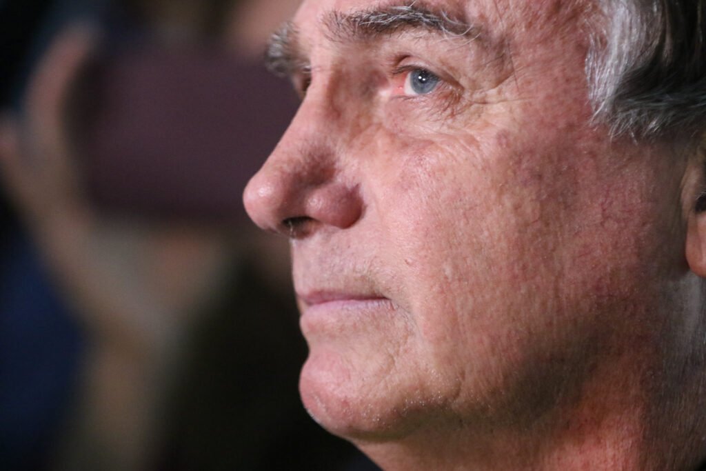 ATÉ QUANDO? Um ex-presidente que levou facada em plena campanha, que governou em meio a pandemia, sabotado dia após dia pela velha política e pela militância de esquerda, hoje vive cercado por laudos, relatórios e exigências semanais. Não é debate eleitoral, não é disputa de narrativa. É a saúde de Jair Bolsonaro sendo monitorada como se fosse um troféu político. Enquanto corruptos históricos da esquerda desfilam livres, dão palestra, ganham documentário e são tratados como estadistas, Bolsonaro precisa justificar até a pressão arterial para o mesmo sistema que sempre tentou calá-lo. Quem ainda acredita que isso é normal? Por que tanto controle médico semanal? Porque faz parte das exigências da execução penal que o mantém em prisão domiciliar, mesmo com quadro estável e acompanhamento constante. Onde está a tal humanidade agora? Ela aparece apenas no papel, já que a chamada prisão domiciliar humanitária vem acompanhada de um cerco burocrático e psicológico que não se vê com figuras da esquerda. Por que só ele é vigiado assim? Porque Bolsonaro virou símbolo a ser destruído, exemplo a ser dado para qualquer conservador que ouse enfrentar o sistema e questionar o poder instalado. Isso é cuidado ou perseguição política? Na prática, parece muito mais um mecanismo de pressão permanente do que simples zelo médico, ainda mais diante da seletividade que o Brasil inteiro enxerga. Quem responde se algo pior acontecer? Ninguém da esquerda, ninguém do STF, ninguém dos que aplaudiram a condenação recorde por "suposta tentativa de golpe" enquanto fecham os olhos para abusos reais de poder. O fato é que o boletim médico fala em estabilidade, mas também em aumento de pressão, efeitos colaterais de remédios, risco de queda, crises de soluço e recuperação lenta. Tudo isso sob o peso de uma condenação de 27 anos e 3 meses que muita gente vê como política. O brasileiro conservador olha para essa situação e se pergunta, com indignação: se fazem isso com um ex-presidente, o que não podem fazer com qualquer cidadão comum?