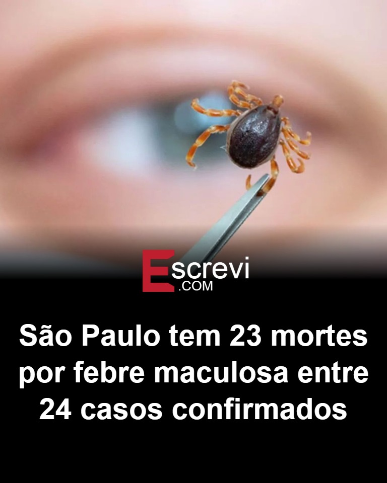 Todo mundo lembra do discurso bonito sobre “saúde pública de qualidade”, “estado forte” e “defesa da vida” que a esquerda repete há anos em São Paulo. Dinheiro nunca faltou, propaganda também não. Mas quando chega a hora de proteger o cidadão comum, longe dos holofotes, o que aparece é sempre o mesmo cenário: abandono, improviso e explicações técnicas que não consolam família nenhuma. Enquanto políticos fazem pose em evento, o interior paulista enfrenta uma realidade dura. Campinas, Piracicaba, Sorocaba, cidades que movimentam a economia do estado, veem a população lidando com uma doença que todo mundo sabe que existe, que é grave e que exige prevenção séria. Mesmo assim, o resultado é devastador. Por que tanta gente ainda morre? A febre maculosa é conhecida, tem protocolo, tem tratamento, mas depende de diagnóstico rápido, orientação clara e vigilância constante. Quando o sistema falha, o carrapato pica e o cidadão paga com a própria vida. Onde está a prioridade do governo? A máquina pública foca em campanhas ideológicas, disputas políticas e narrativas, enquanto a vida real cobra outra conta. A conta chegou em forma de 23 mortes em apenas 24 casos confirmados em 2026 em São Paulo. Números assim seriam tolerados na direita? Claro que não. Se fosse governo conservador, já estariam gritando “genocídio” em rede nacional, com artistas engajados, militância organizada e manchetes diárias. Mas quando o problema explode em gestão alinhada à esquerda, o tom muda, tudo vira “fatalidade” e “complexidade epidemiológica”. Por que ninguém assume responsabilidade? Porque é mais fácil culpar o clima, o carrapato, o acaso, do que admitir que faltou prevenção, informação direta à população e ação firme nas áreas de risco. No fim, o dado fala mais alto que qualquer discurso: 24 casos confirmados, 23 mortes. Em pleno estado mais rico do país. E a pergunta que fica é simples e incômoda: até quando o brasileiro vai aceitar que a ideologia venha antes da vida?