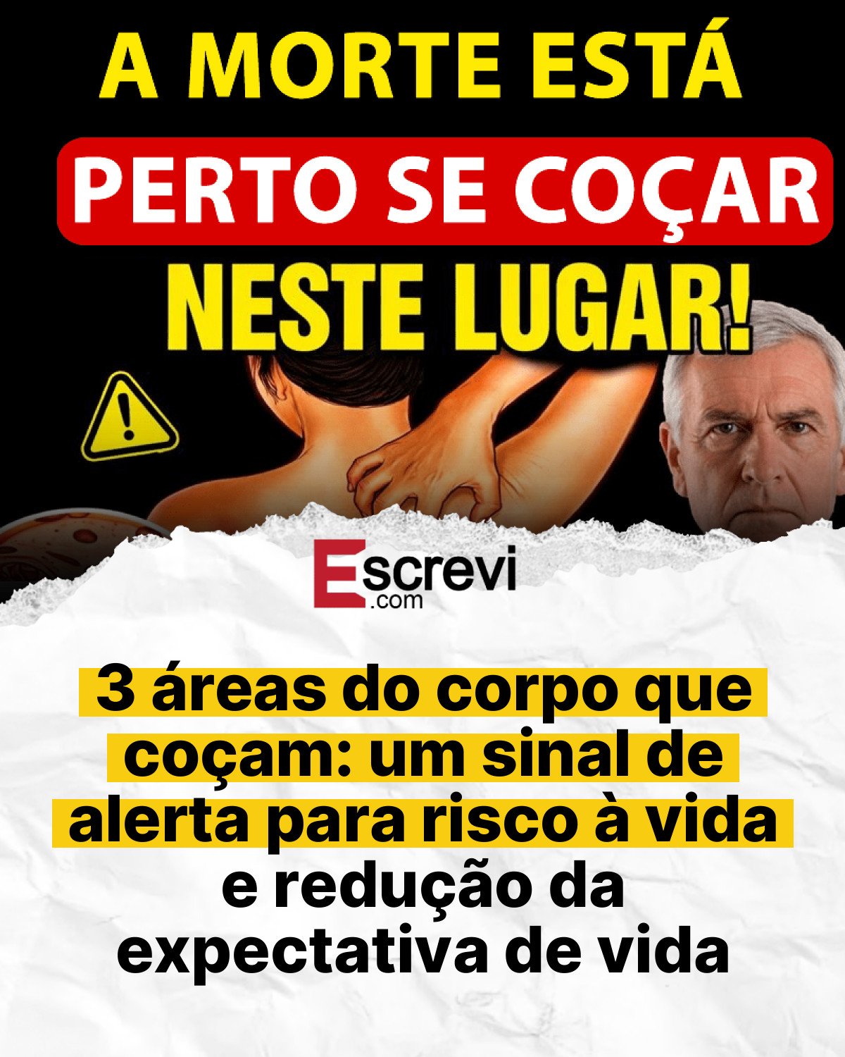 3 áreas do corpo que coçam: um sinal de alerta para risco à vida e redução da expectativa de vida card branco
