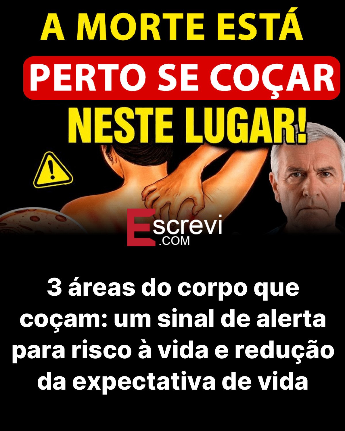 3 áreas do corpo que coçam: um sinal de alerta para risco à vida e redução da expectativa de vida card preto