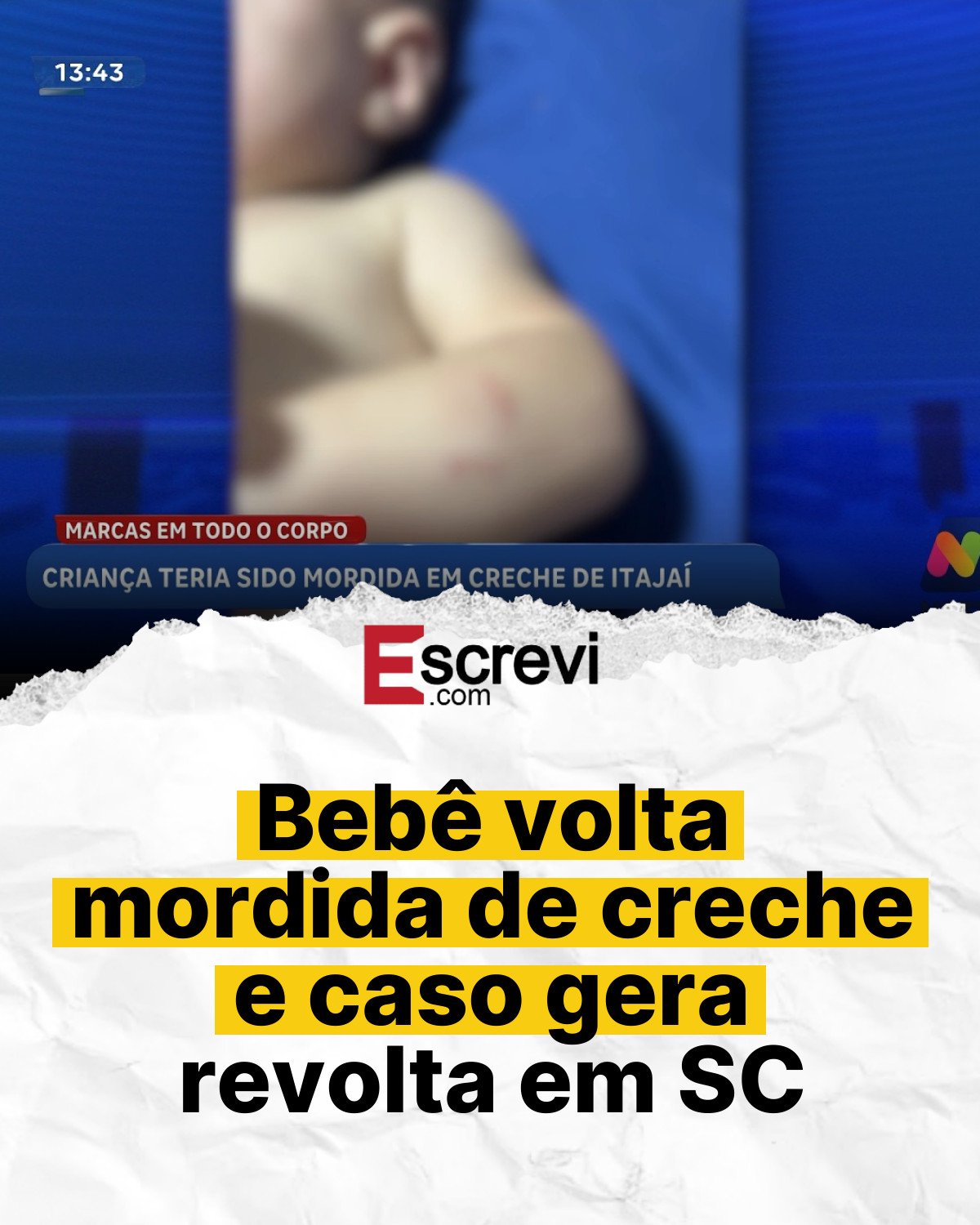 Bebê volta mordida de creche e caso gera revolta em SC card branco