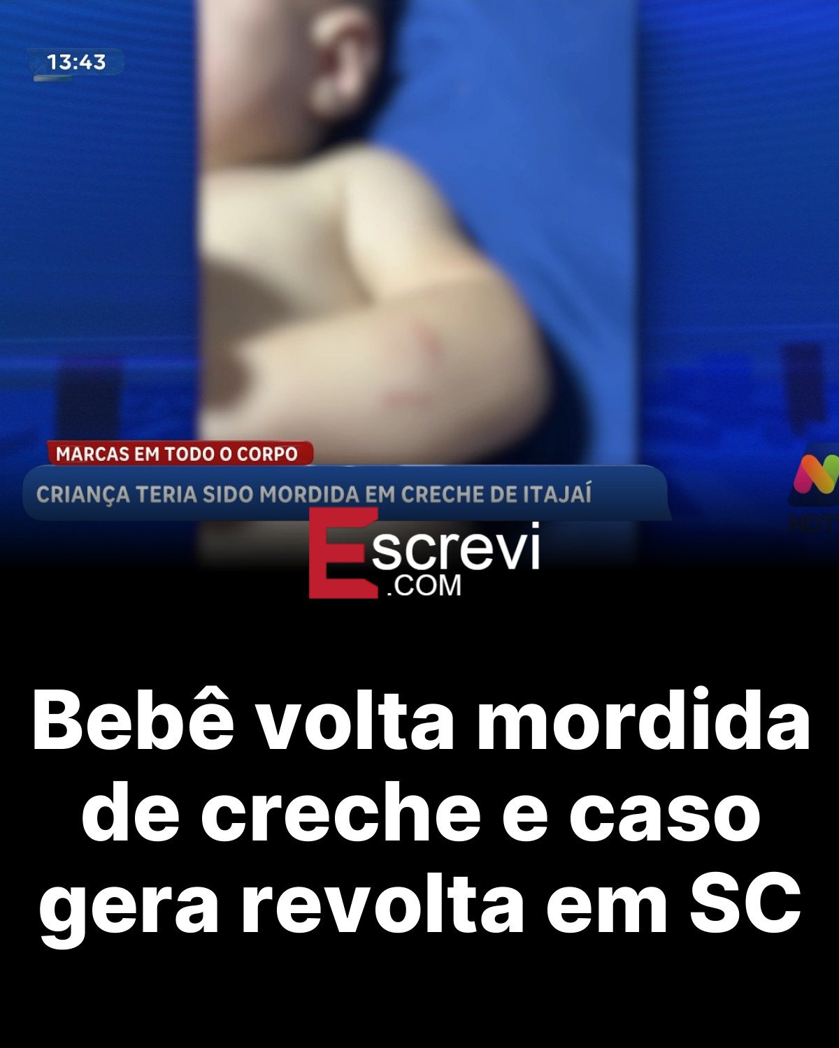 Bebê volta mordida de creche e caso gera revolta em SC card preto