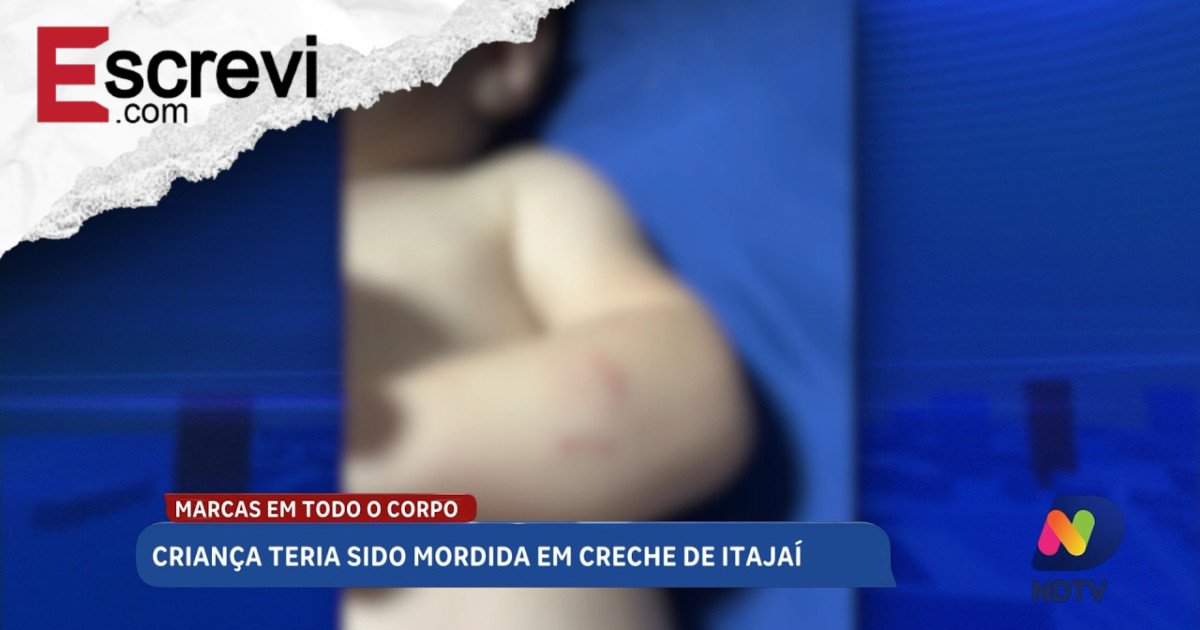 Bebê volta mordida de creche e caso gera revolta em SC imagem principal