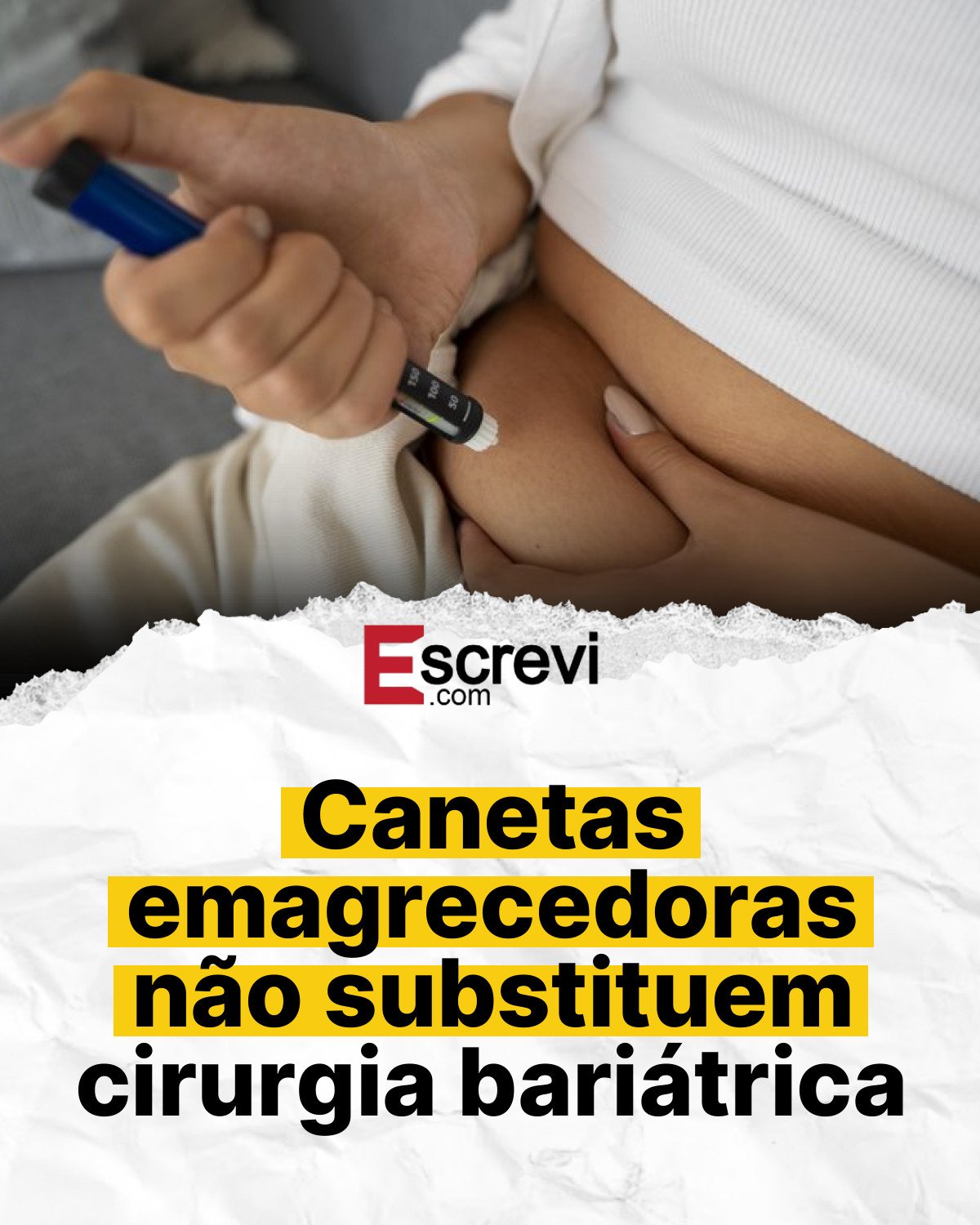 Canetas emagrecedoras não substituem cirurgia bariátrica card branco