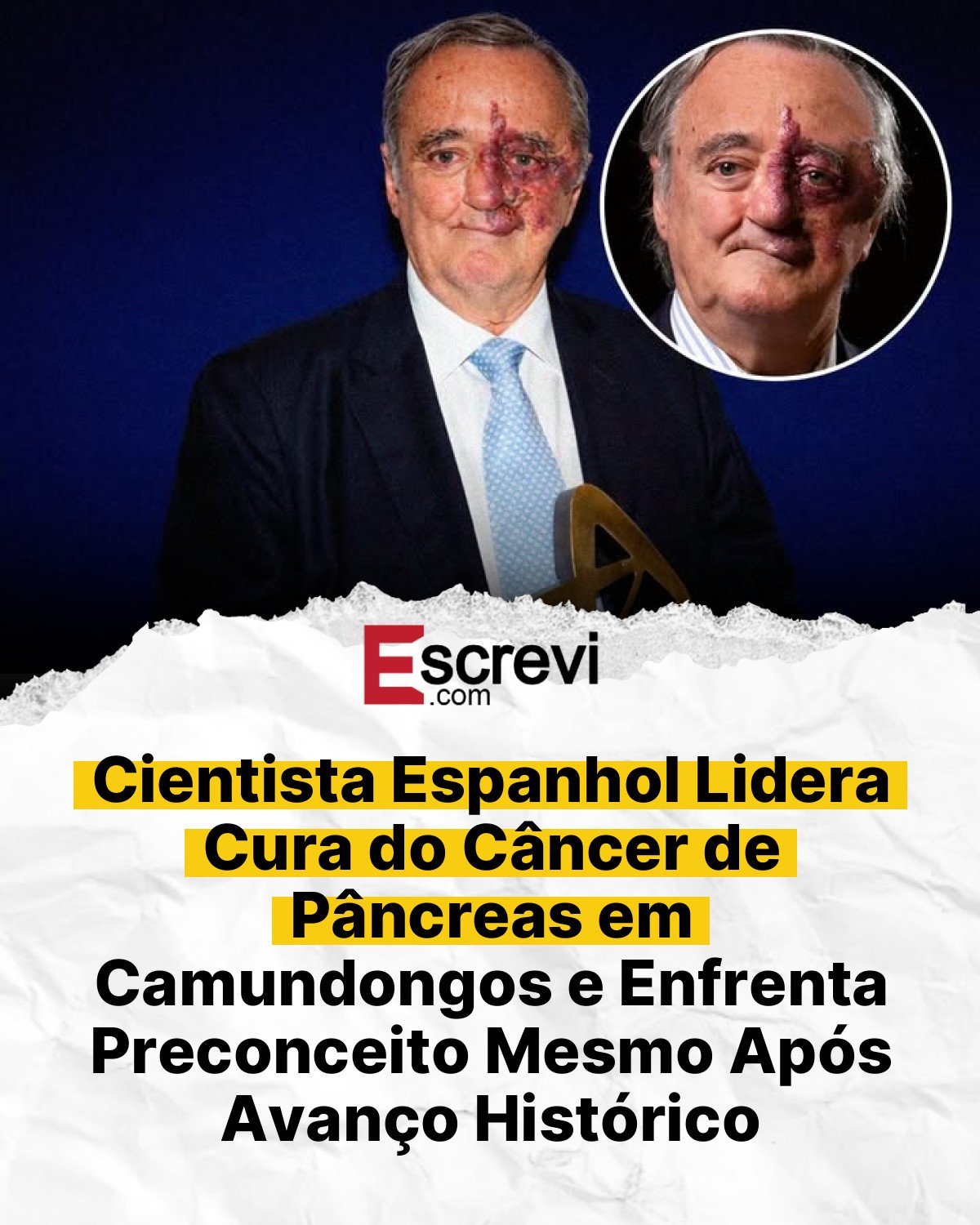 Cientista Espanhol Lidera Cura do Câncer de Pâncreas em Camundongos e Enfrenta Preconceito Mesmo Após Avanço Histórico card branco