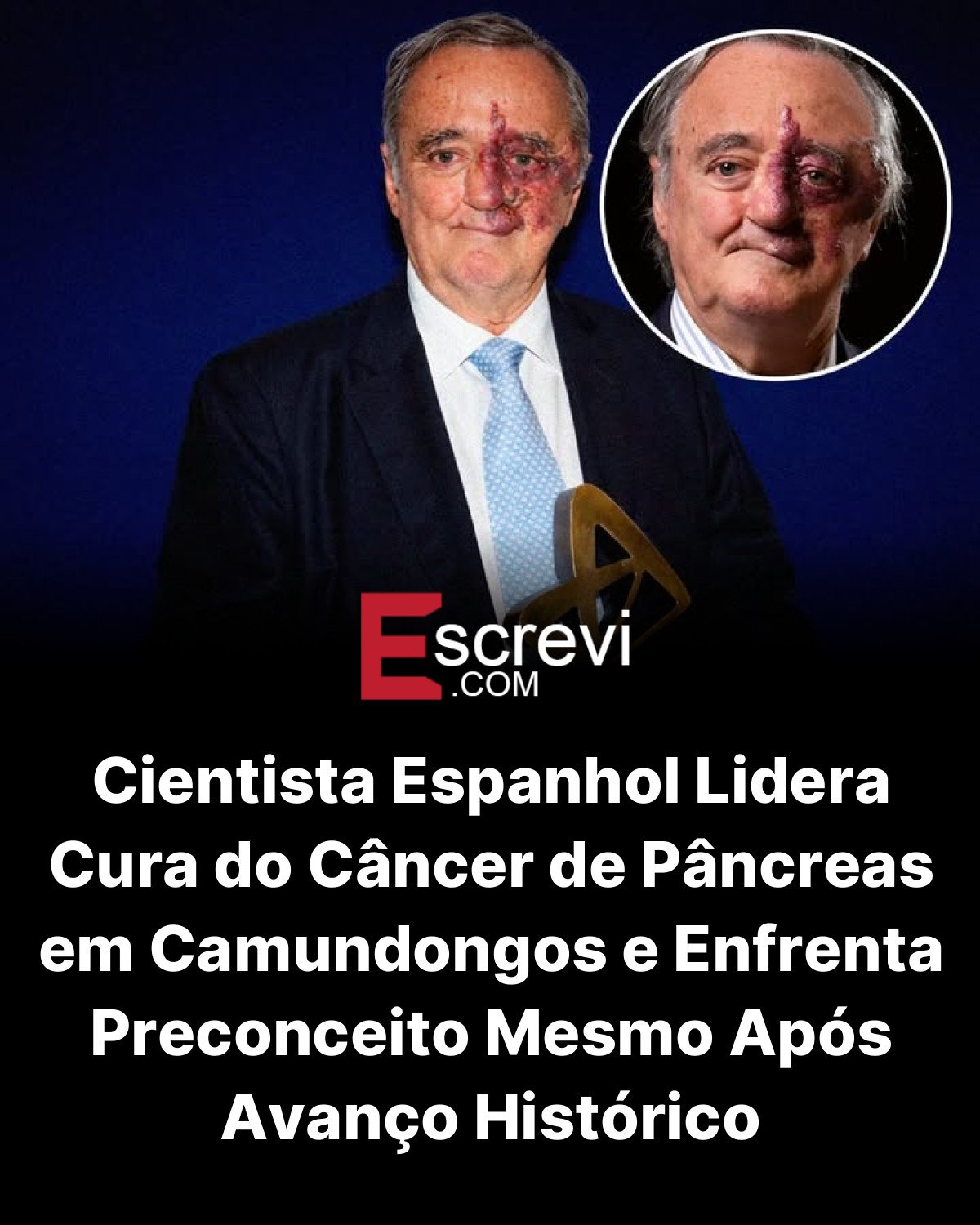 Cientista Espanhol Lidera Cura do Câncer de Pâncreas em Camundongos e Enfrenta Preconceito Mesmo Após Avanço Histórico card preto