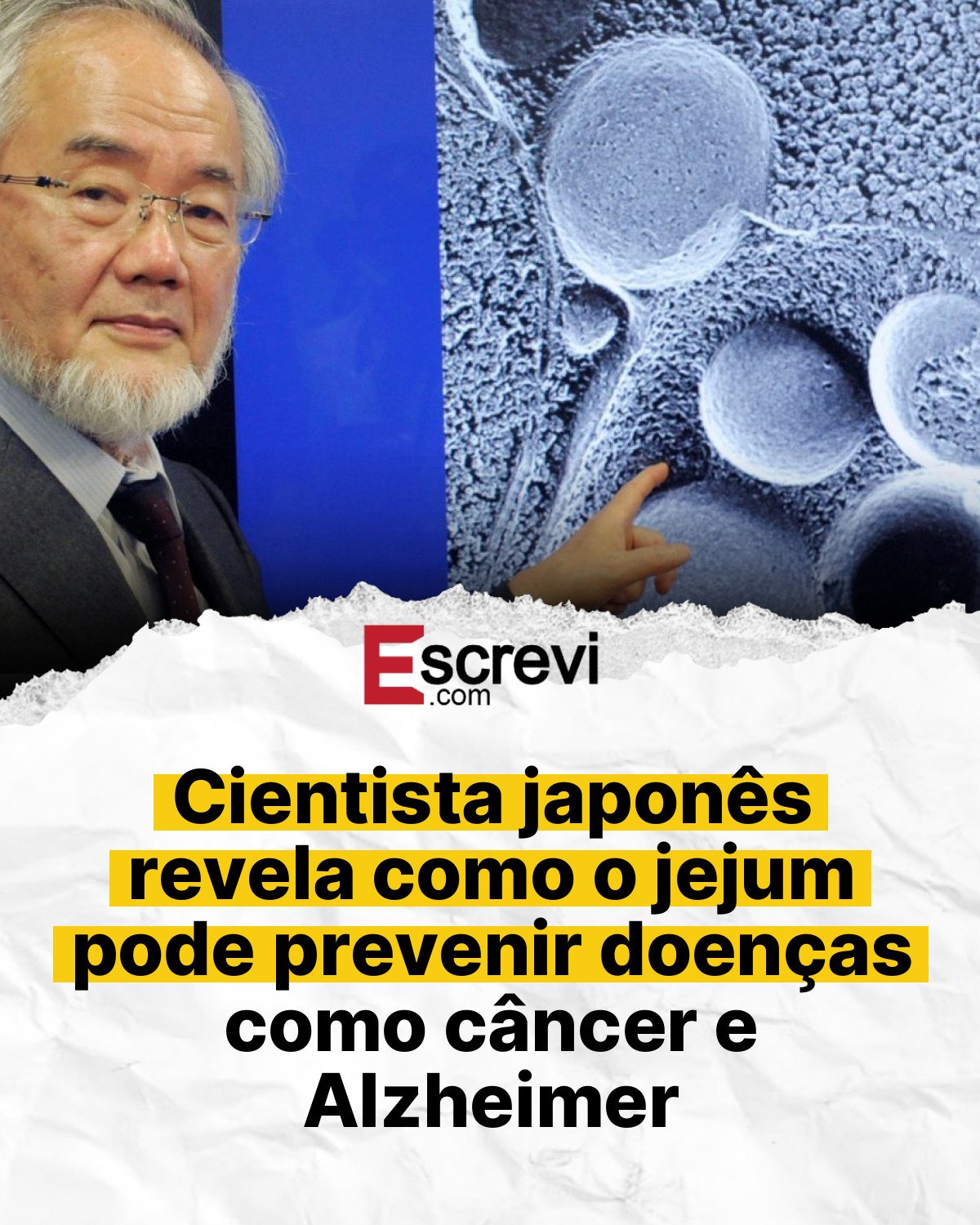 Cientista japonês revela como o jejum pode prevenir doenças como câncer e Alzheimer card branco