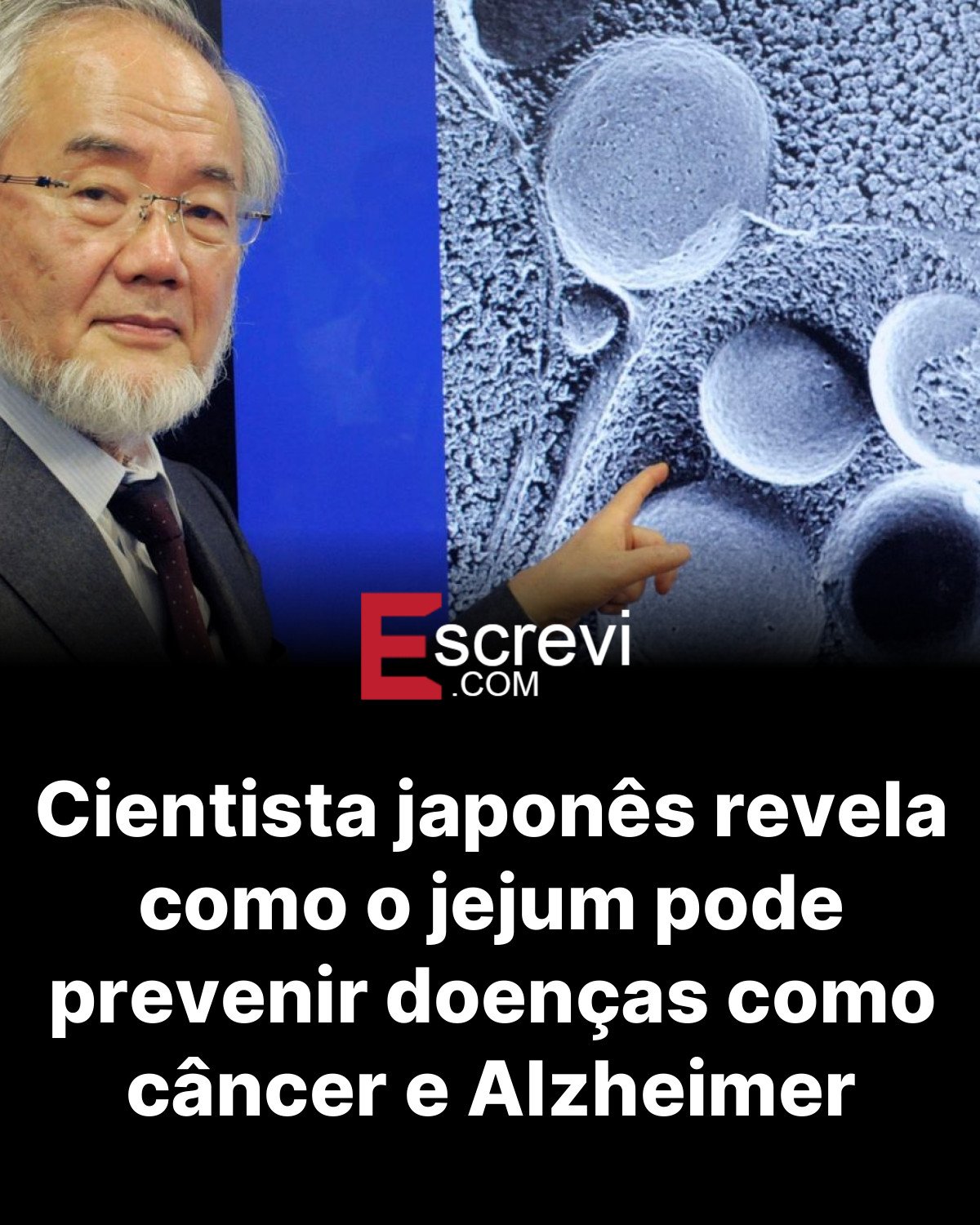 Cientista japonês revela como o jejum pode prevenir doenças como câncer e Alzheimer card preto