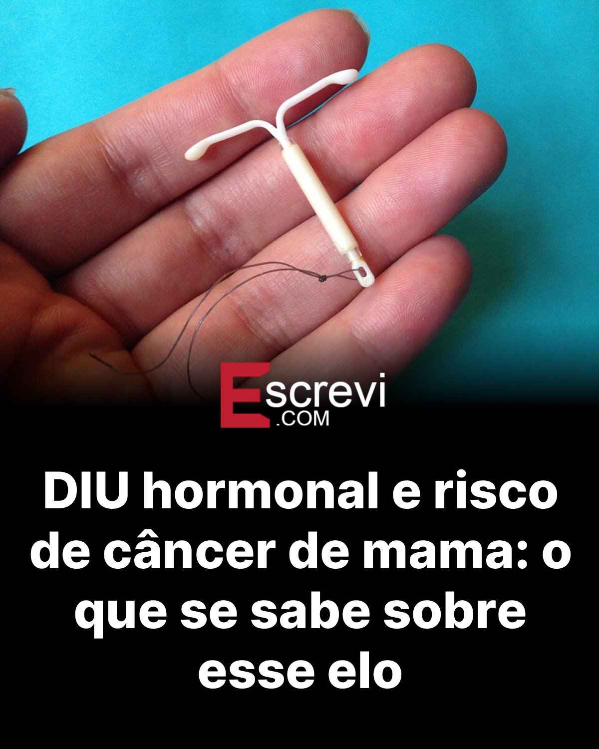 DIU hormonal e risco de câncer de mama: o que se sabe sobre esse elo card preto