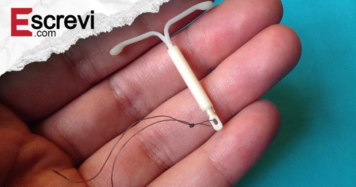 DIU hormonal e risco de câncer de mama: o que se sabe sobre esse elo imagem principal