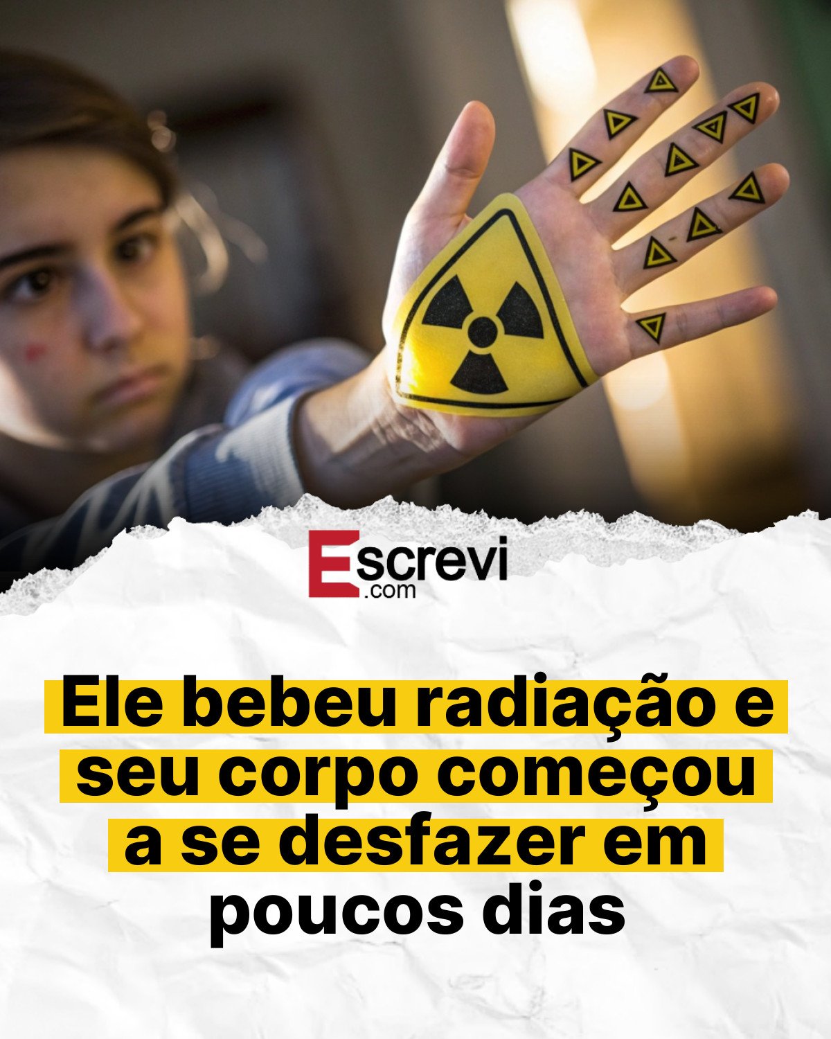 Ele bebeu radiação e seu corpo começou a se desfazer em poucos dias card branco