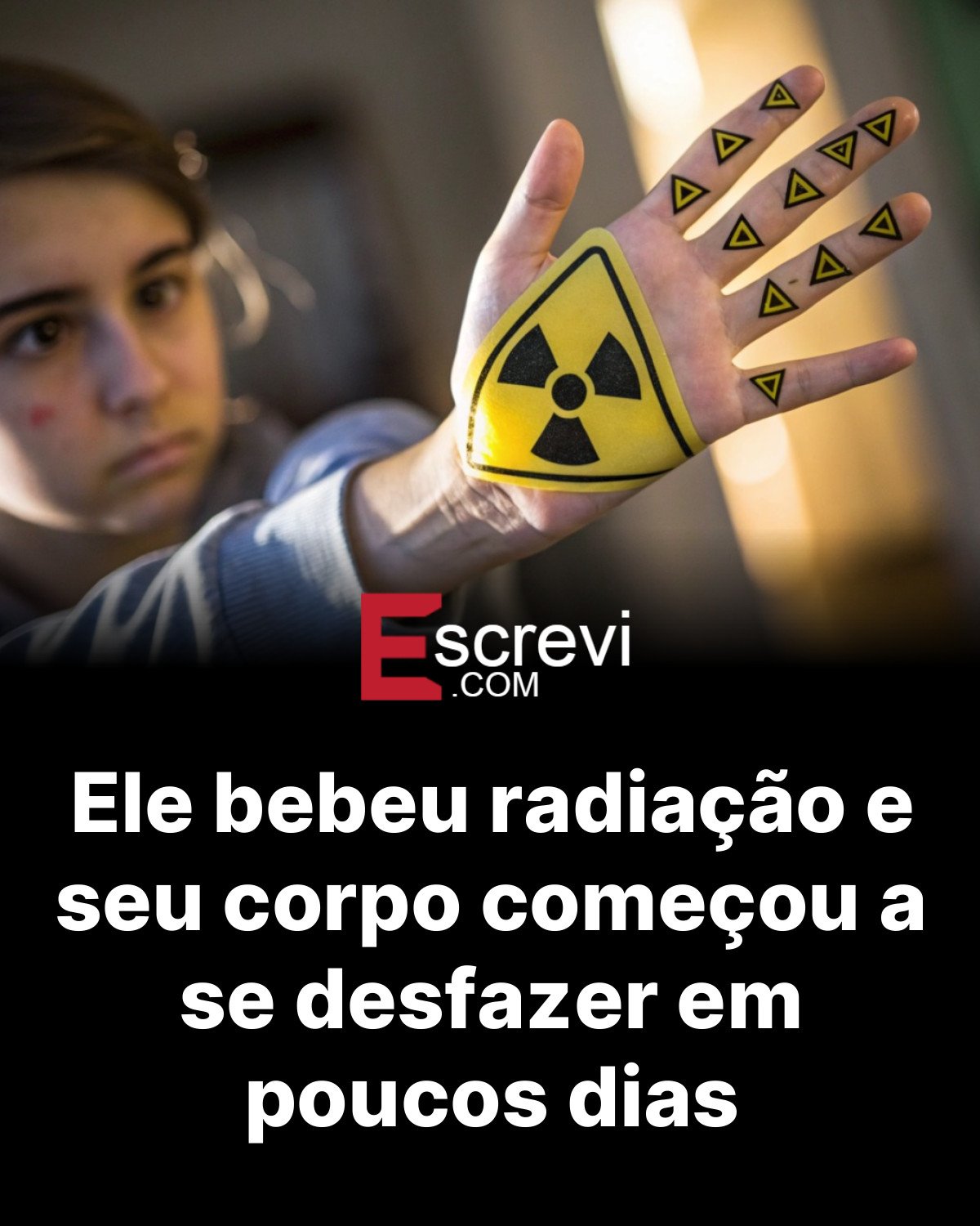 Ele bebeu radiação e seu corpo começou a se desfazer em poucos dias card preto