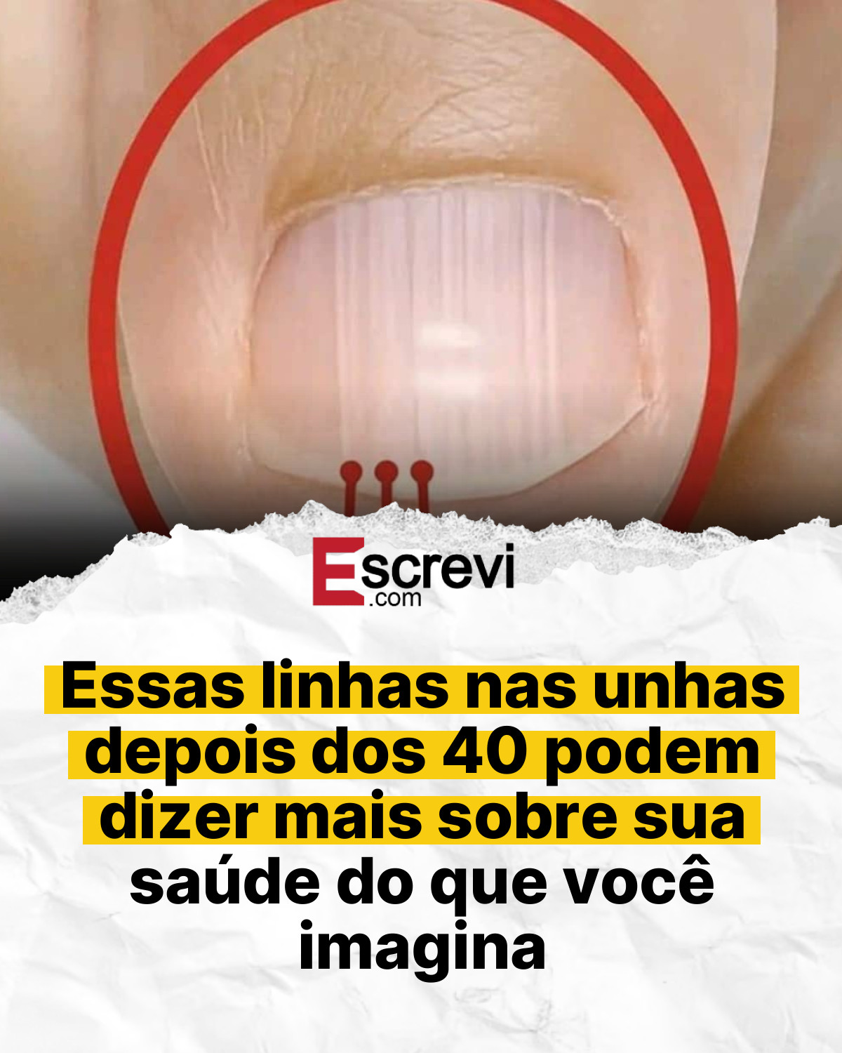 Essas linhas nas unhas depois dos 40 podem dizer mais sobre sua saúde do que você imagina card branco