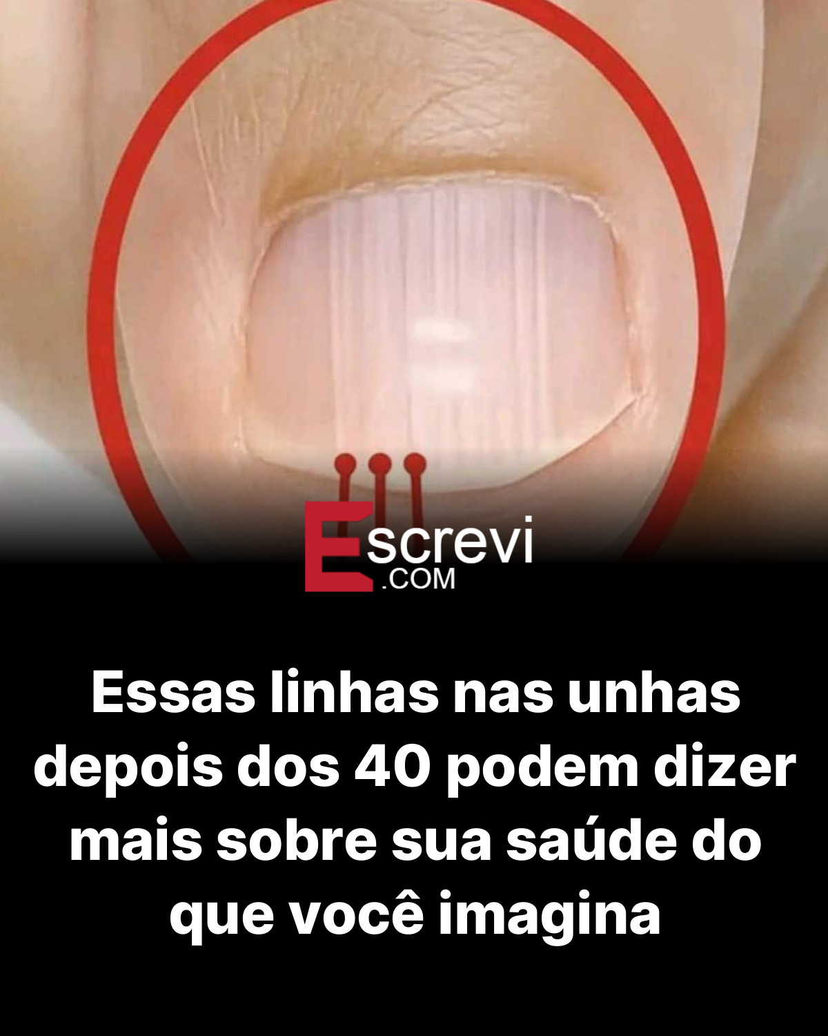 Essas linhas nas unhas depois dos 40 podem dizer mais sobre sua saúde do que você imagina card preto