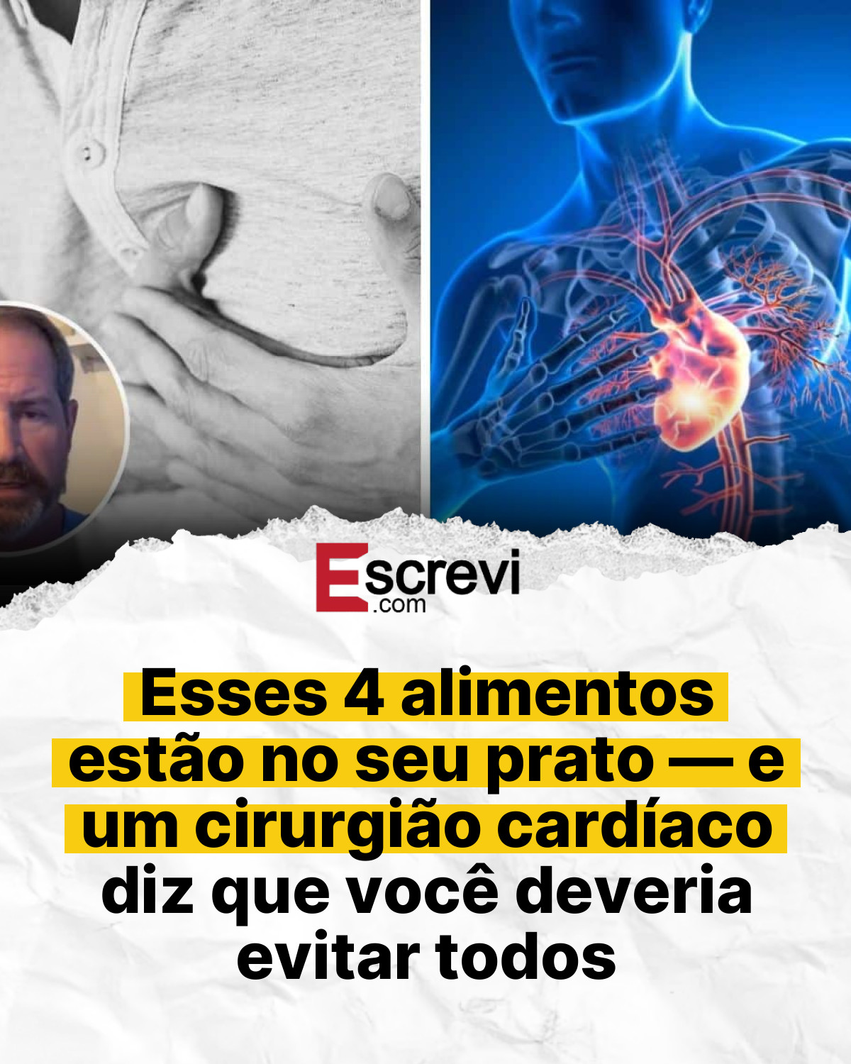 Esses 4 alimentos estão no seu prato — e um cirurgião cardíaco diz que você deveria evitar todos card branco