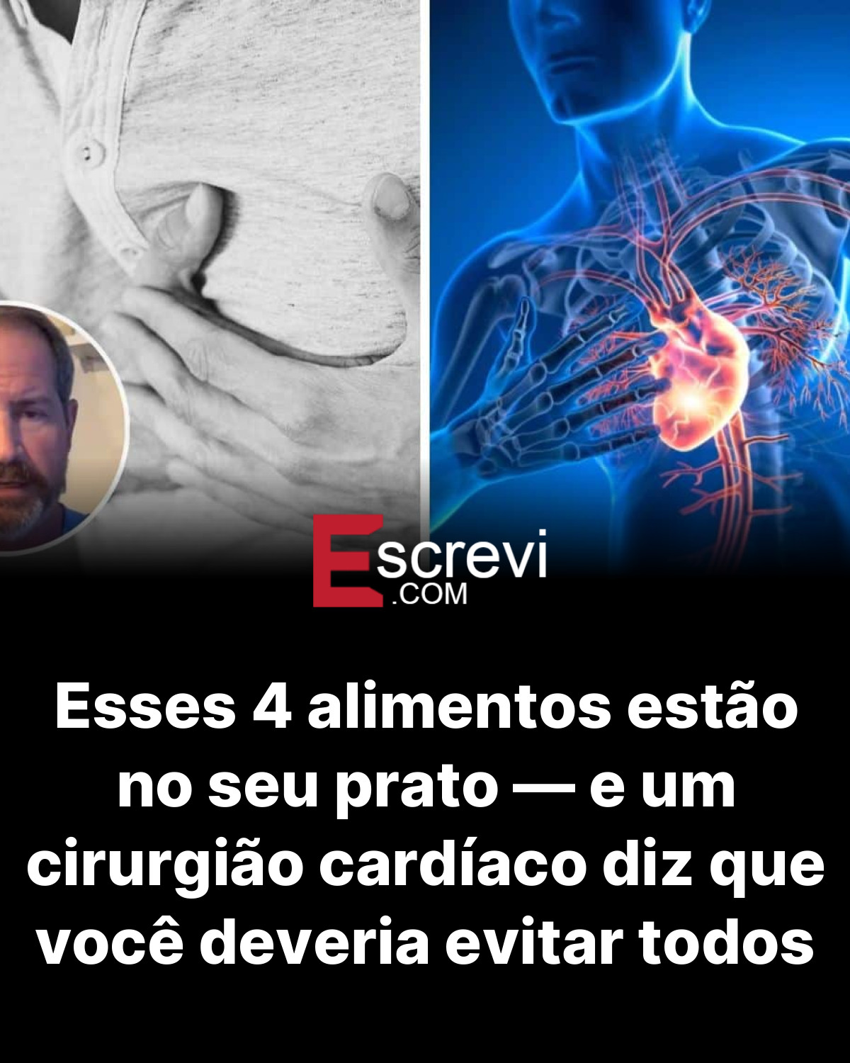 Esses 4 alimentos estão no seu prato — e um cirurgião cardíaco diz que você deveria evitar todos card preto