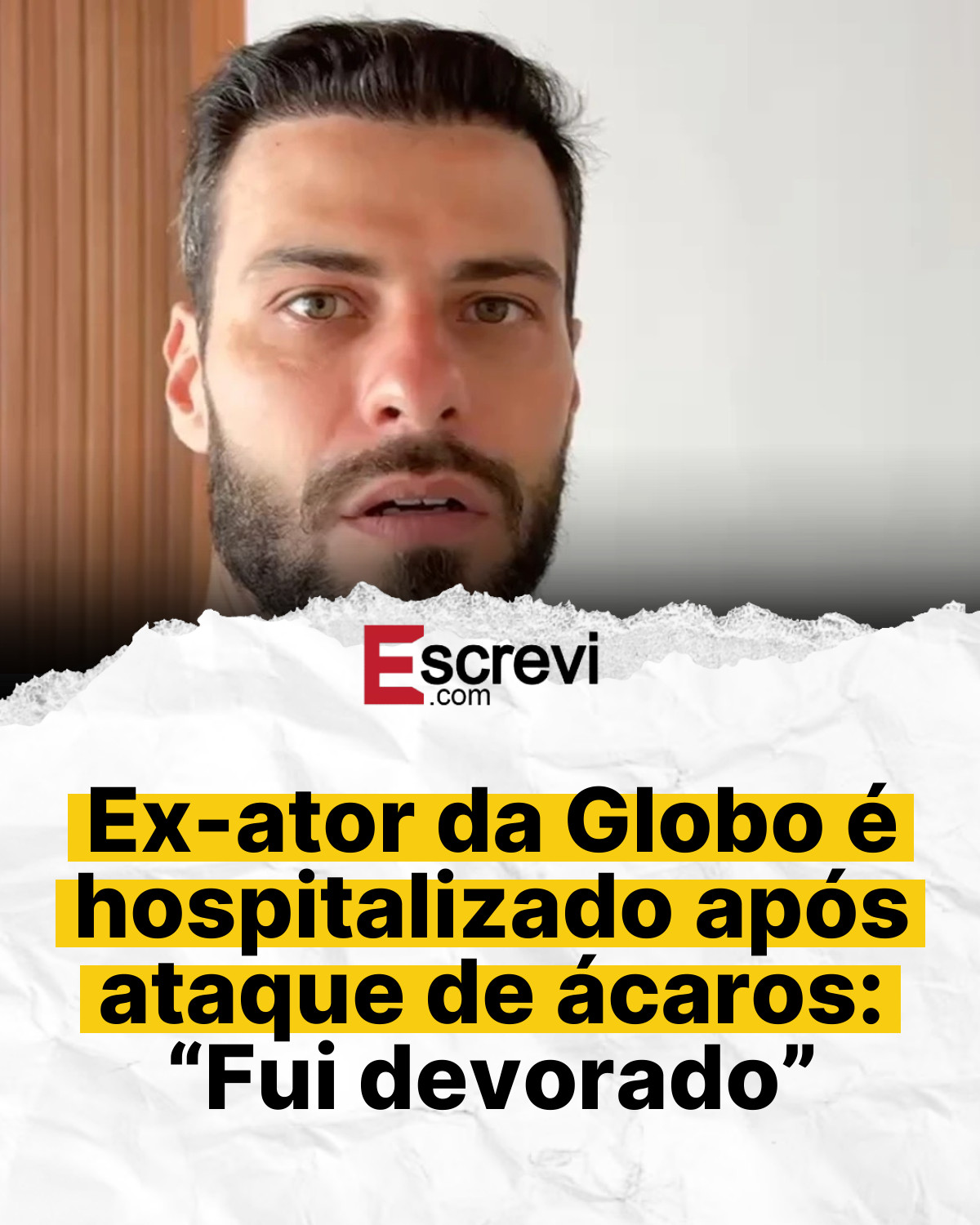 Ex-ator da Globo é hospitalizado após ataque de ácaros: “Fui devorado” card branco