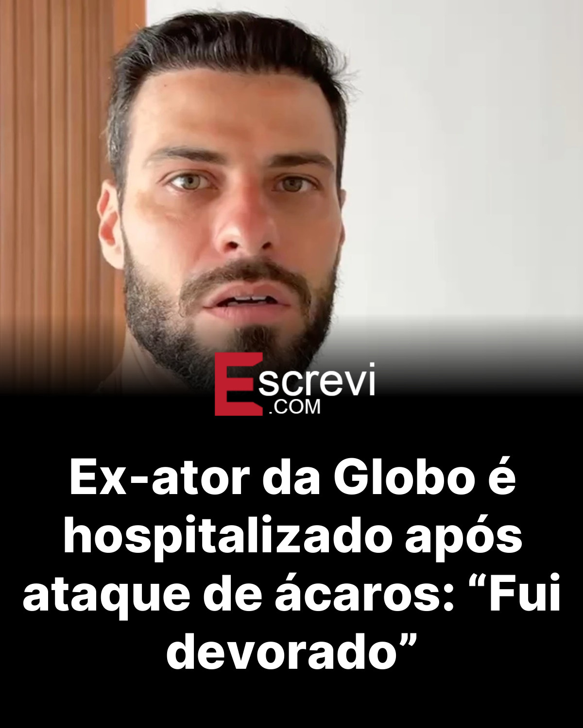 Ex-ator da Globo é hospitalizado após ataque de ácaros: “Fui devorado” card preto