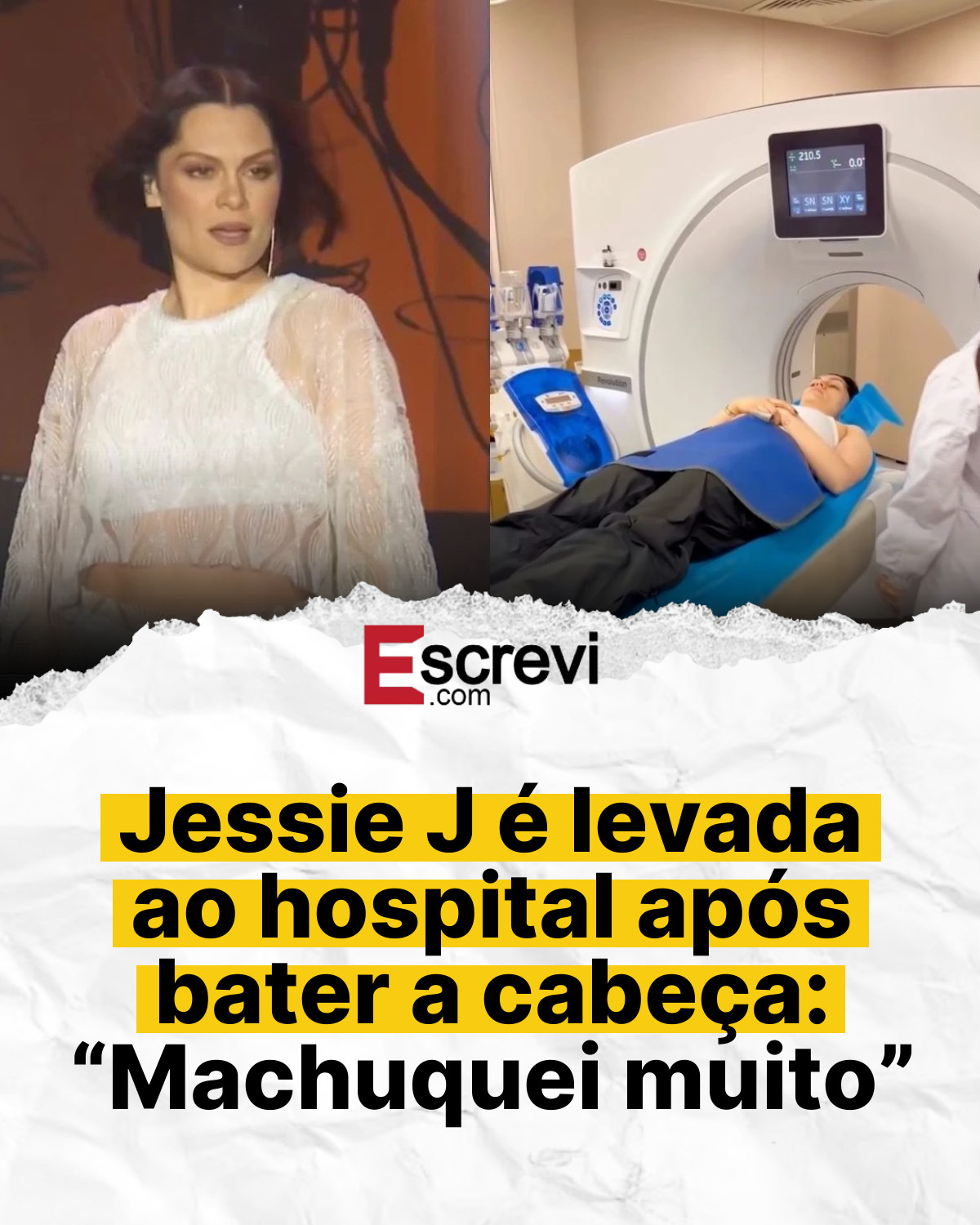 Jessie J é levada ao hospital após bater a cabeça: “Machuquei muito” card branco